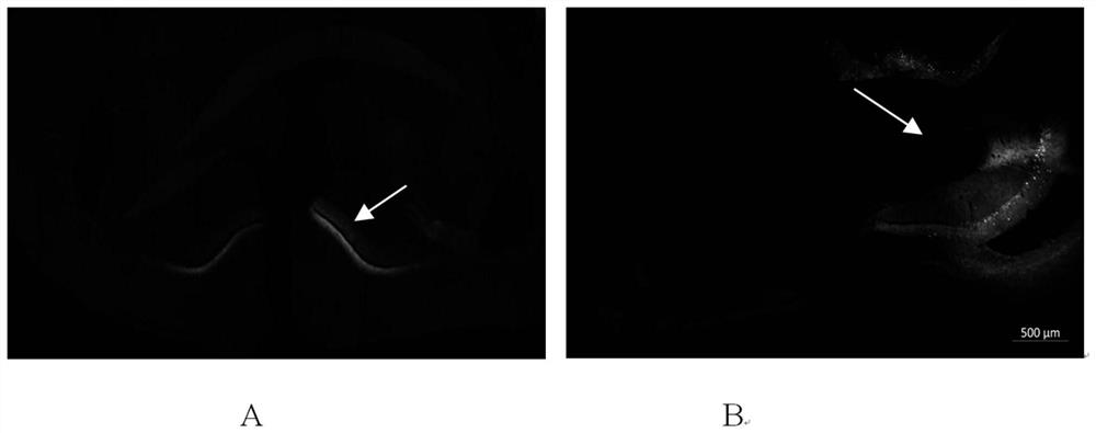 Method for accelerating protein-like propagation of tau pathology in brain of C57BL6 mouse