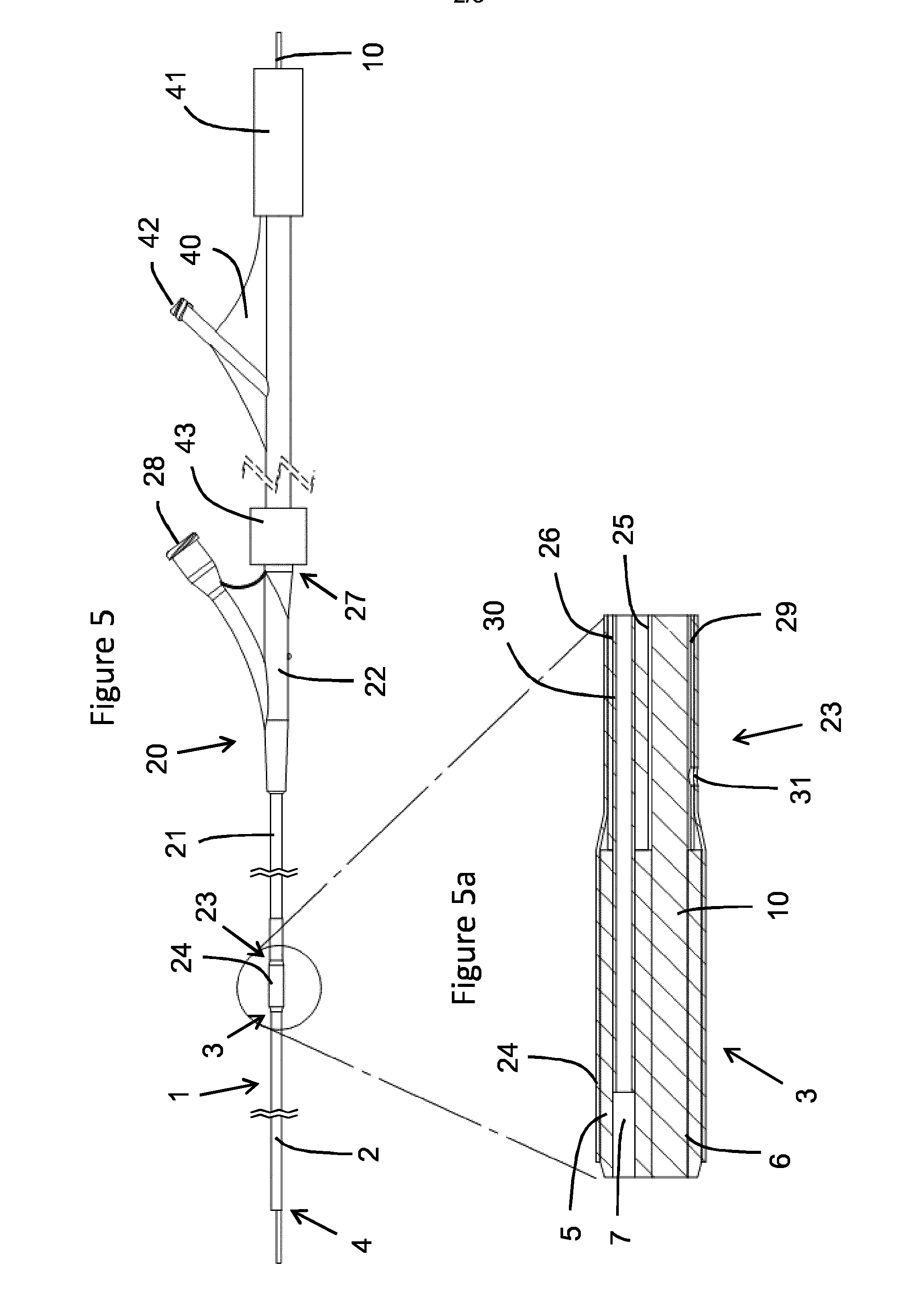 Catheter system for delivery of a ureteral catheter