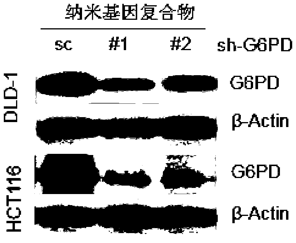 Application of g6pd gene and its expression product in the treatment of colorectal cancer