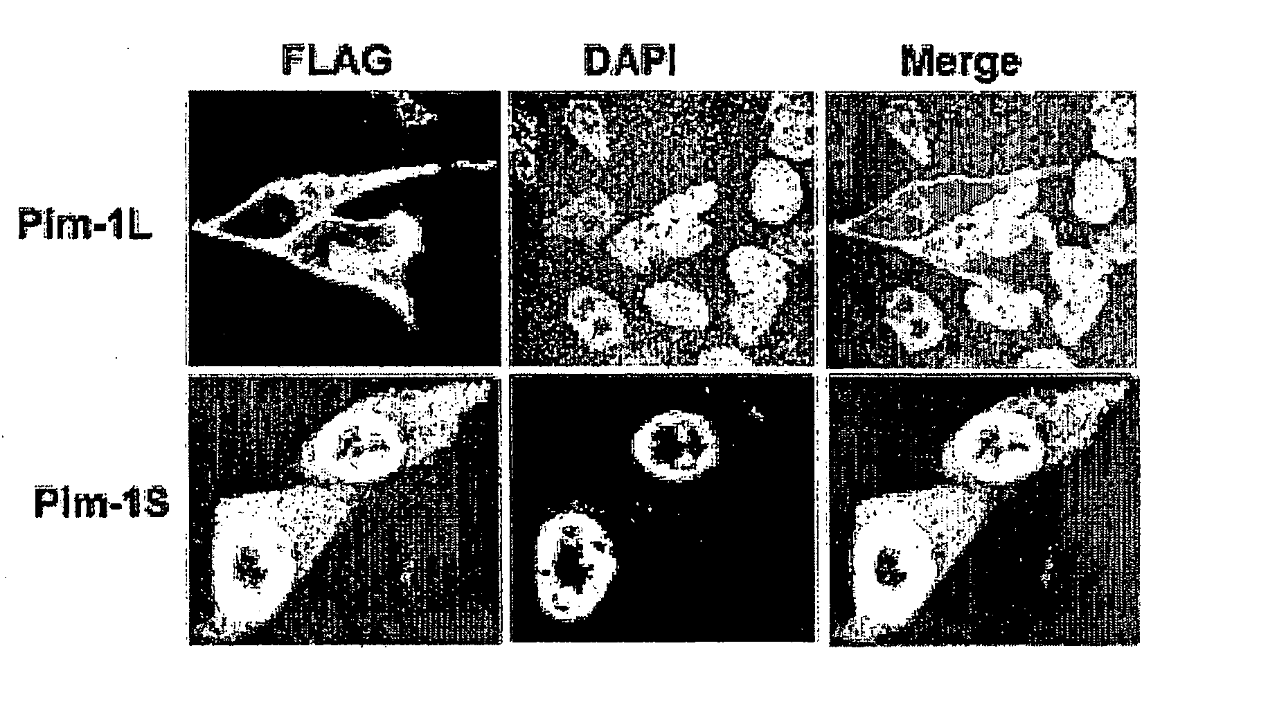 Inhibition of the 44 kilodalton isoform of pim-1 kinase restores apoptosis induced by chemotherapeutic drugs in cancer cells