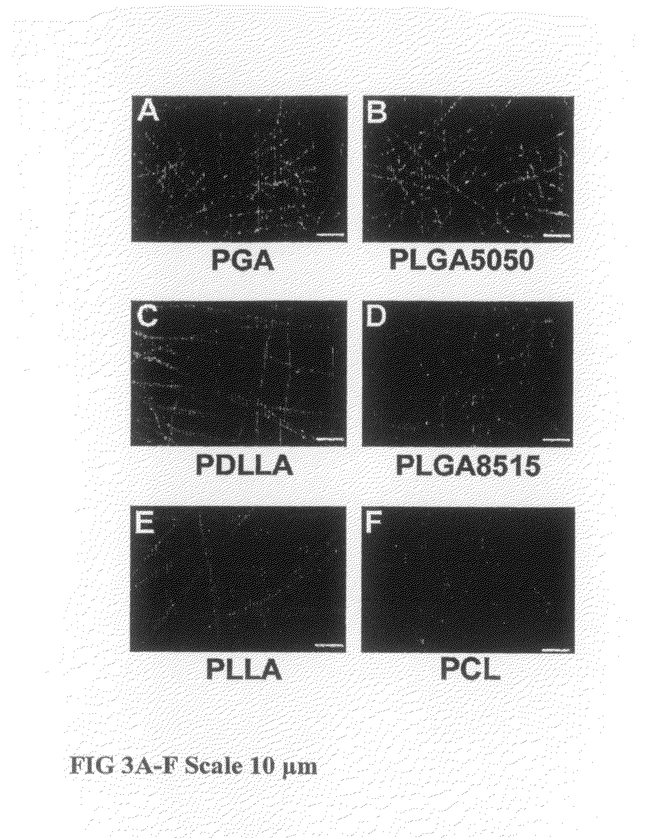 Tissue Engineered Cartilage, Method of Making Same, Therapeutic and Cosmetic Surgical Applications Using Same