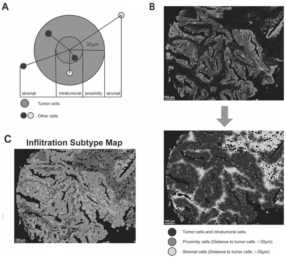 Application of reagent for detecting spatial distribution of immune checkpoints in preparation of tumor treatment and prognosis products