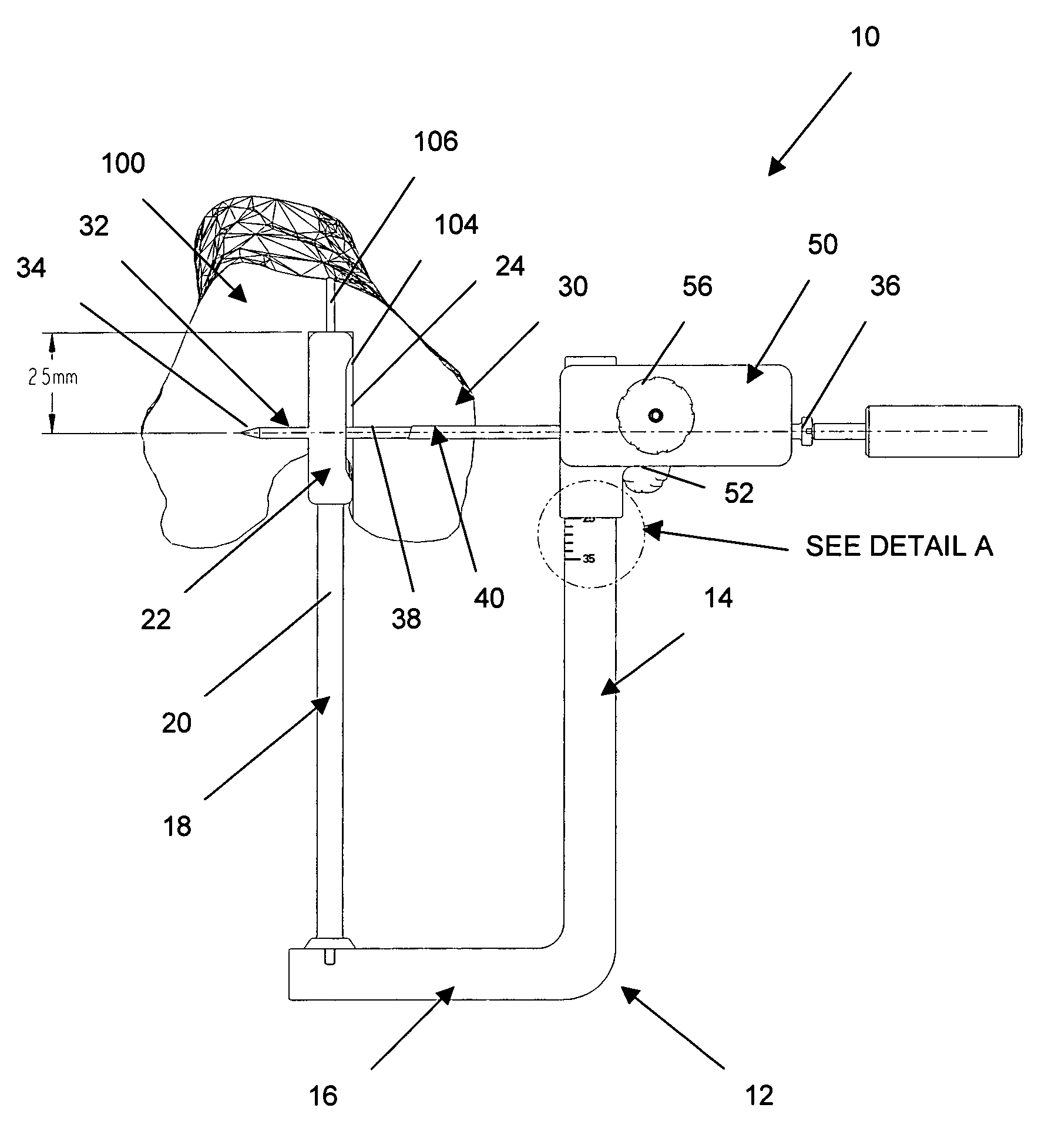 Adjustable drill guide assembly and method of use