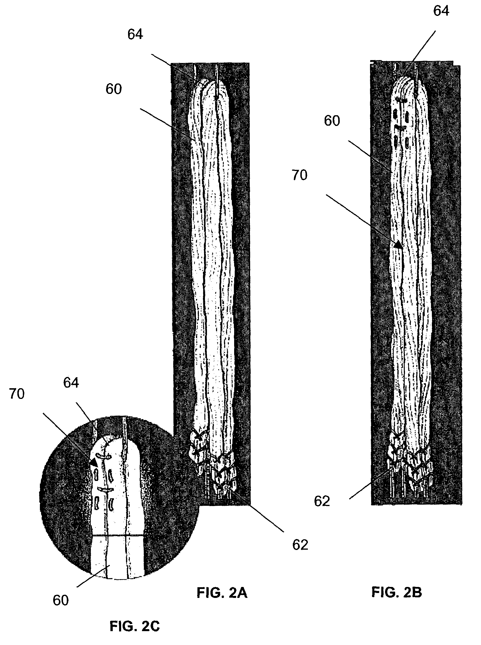 Adjustable drill guide assembly and method of use