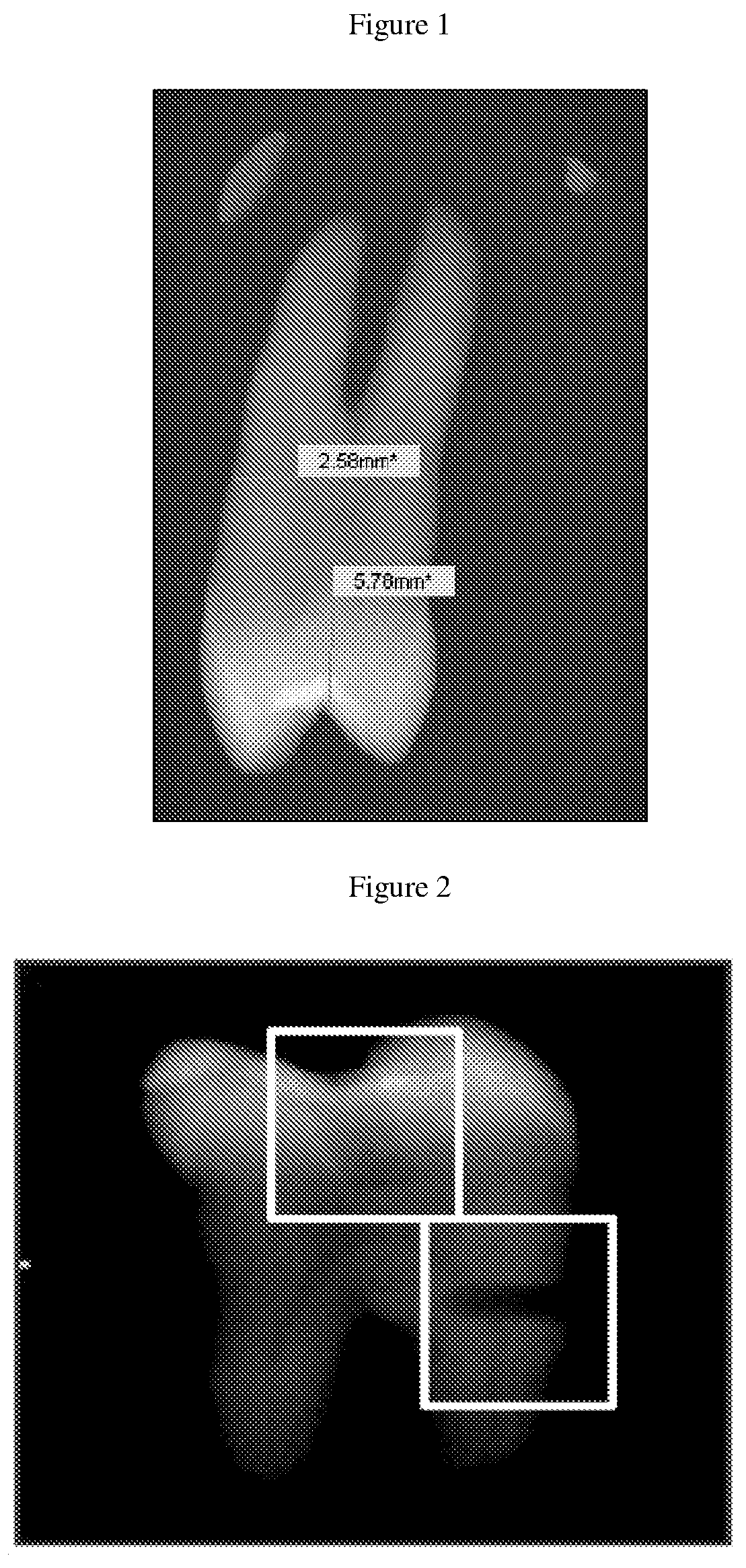 Method, systems and kit for forensic identification, post mortem interval estimation and cause of death determination by recovery of dental tissue in physiological conditions