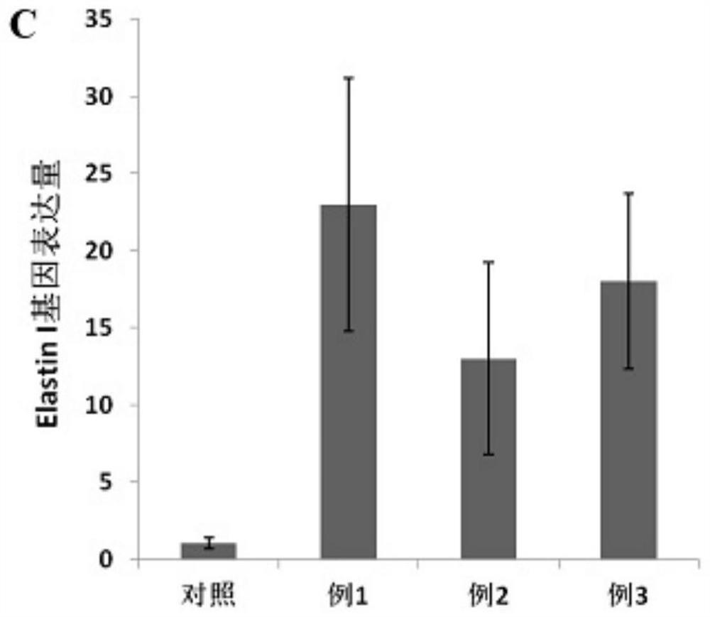 Culture induction liquid for umbilical cord and placenta mesenchymal stem cells