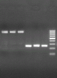 Rapid detection kit for fragile X syndrome