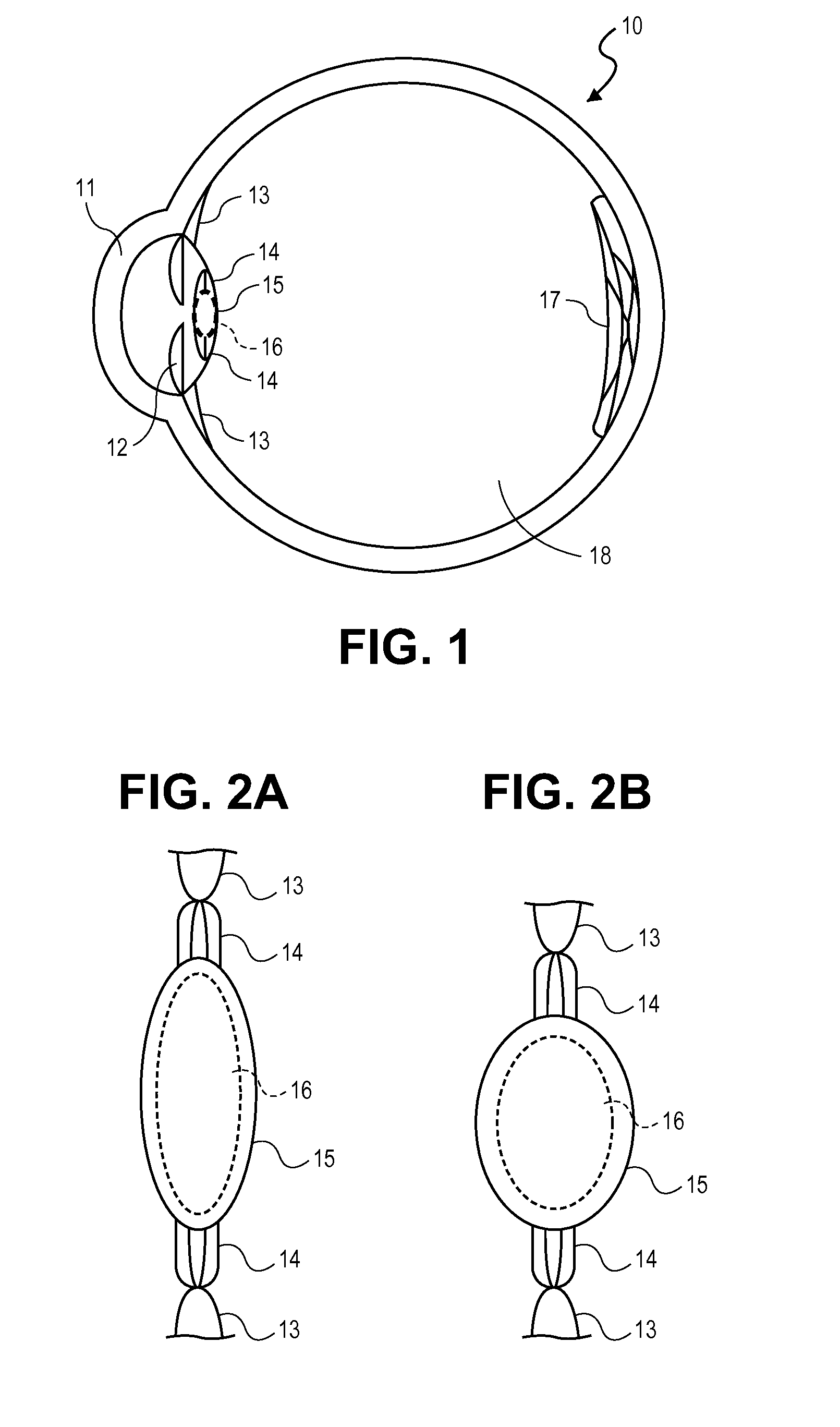 Intraocular Lenses and Methods of Accounting for Capsule Size Variability and Post-Implant Changes in the Eye