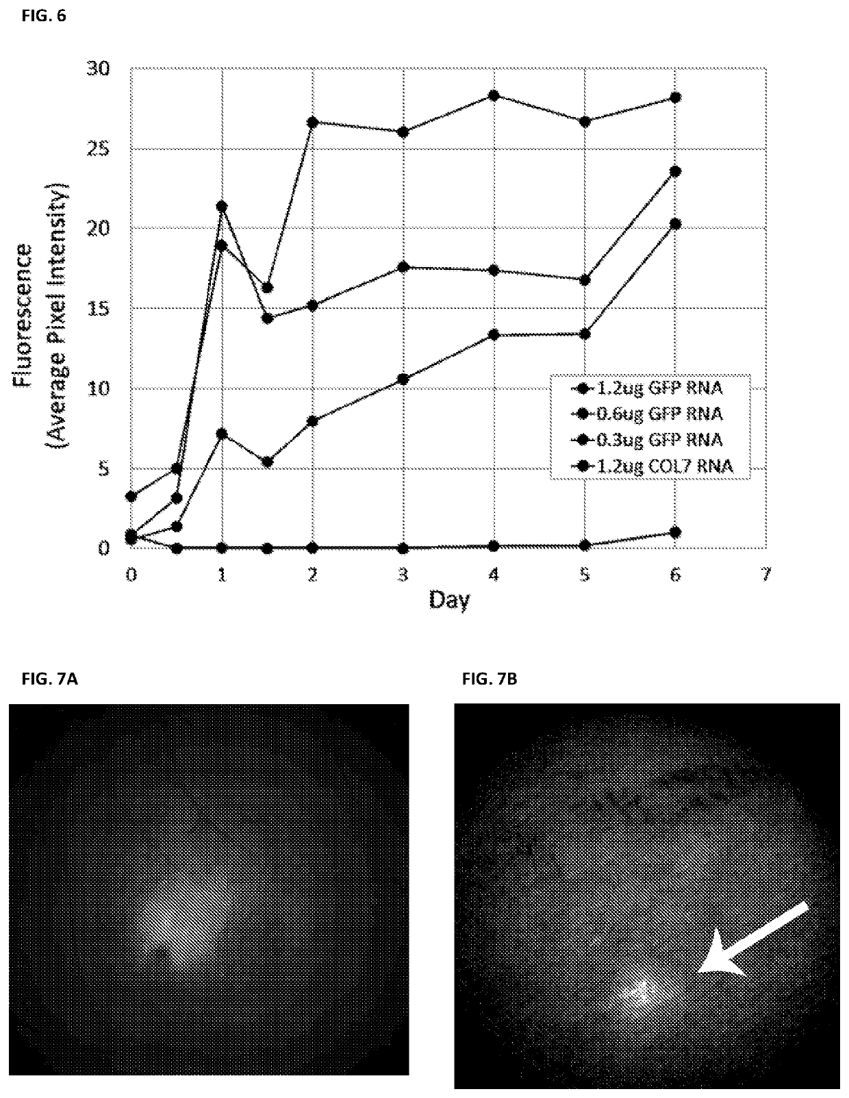 Nucleic acid-based therapeutics