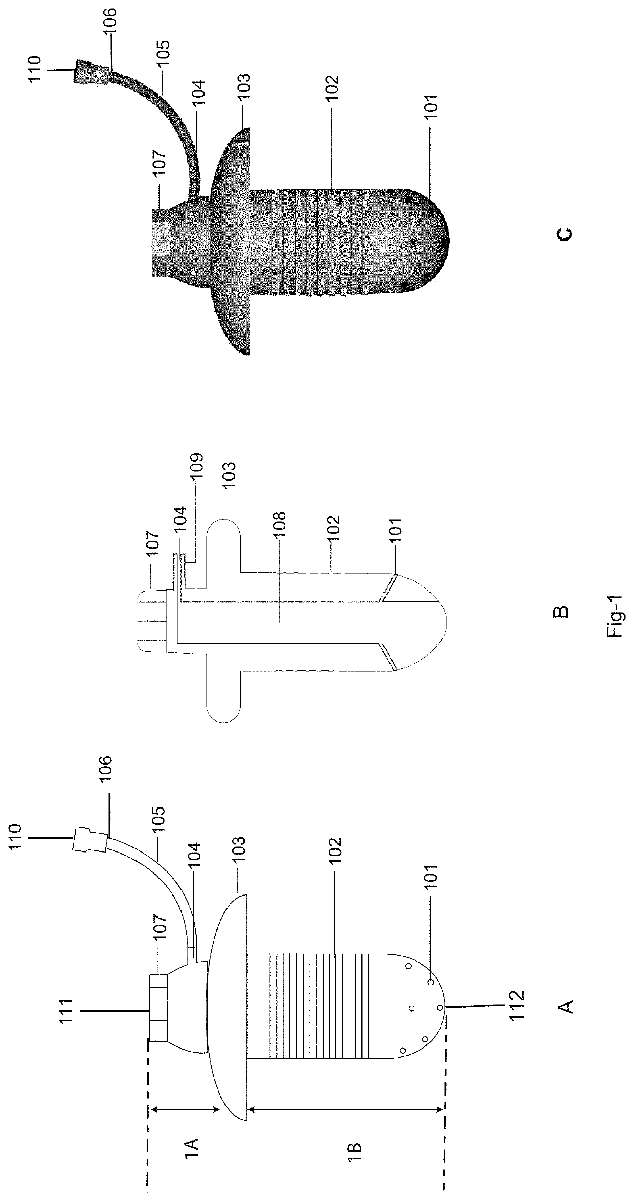 Drug delivery system and method for controlled and continuous delivery of drugs into the brain by bypassing the blood brain barrier