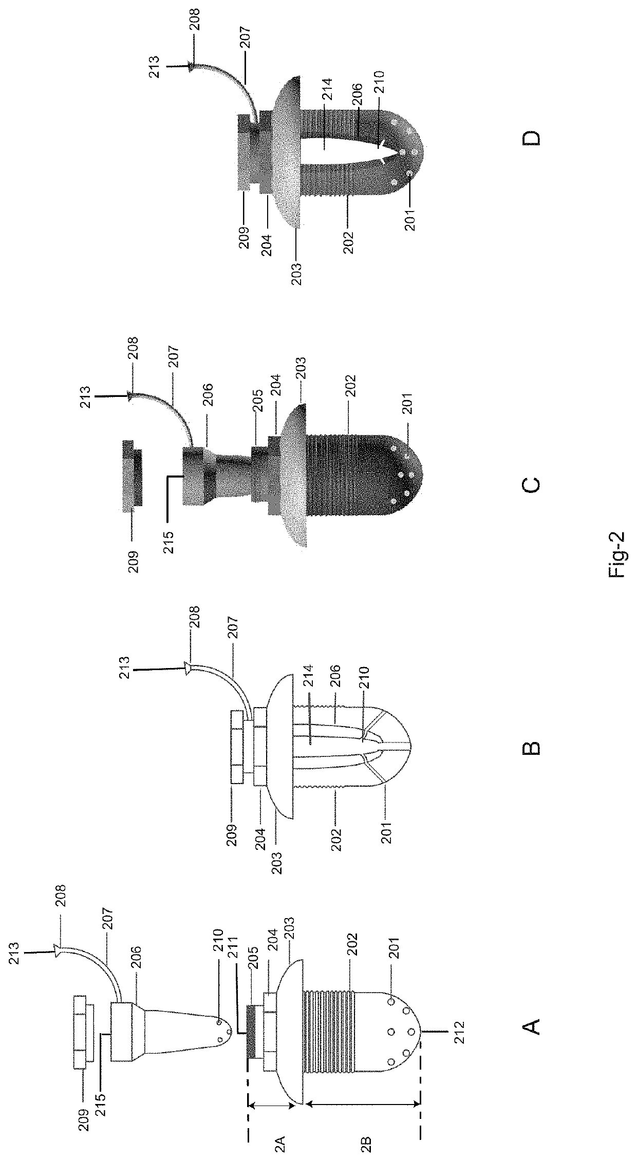 Drug delivery system and method for controlled and continuous delivery of drugs into the brain by bypassing the blood brain barrier