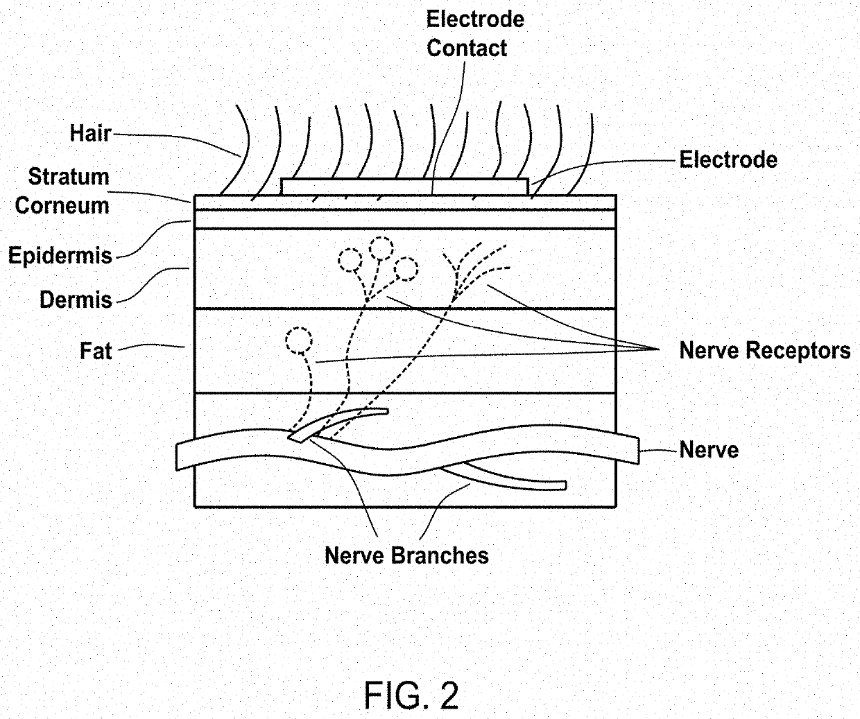 Device and method to modulate a nervous system structure to non-invasively and non-destructively inhibit nervous signaling