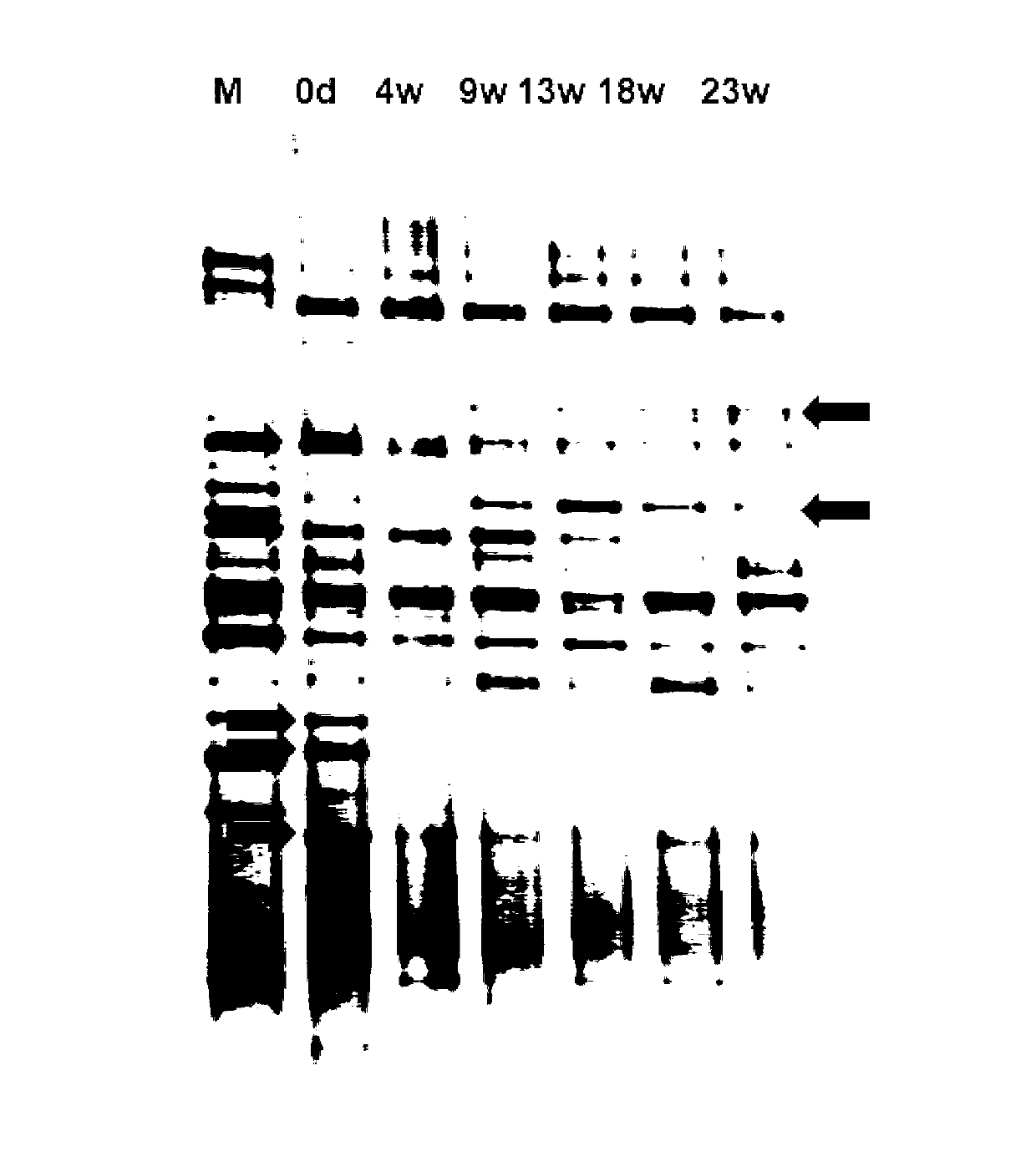 Total nutrient composition for balancing intestinal flora structure and improving metabolic syndrome and application thereof