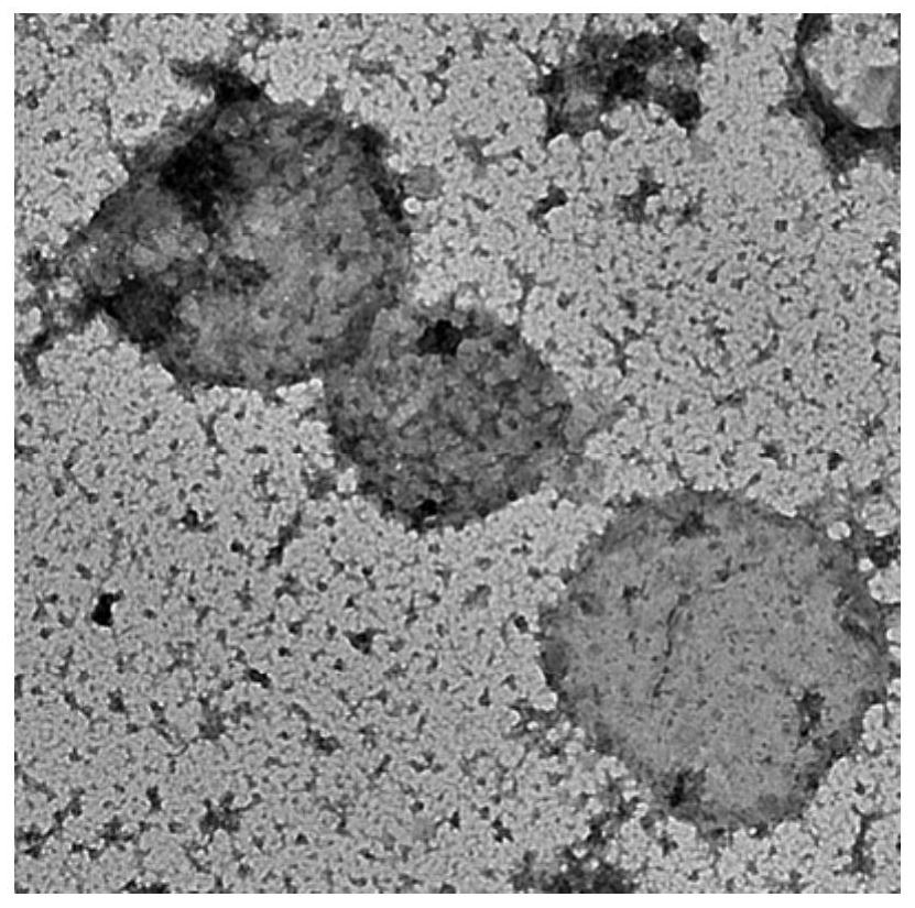 A kind of preparation method of lysosomal membrane coating nanoparticle