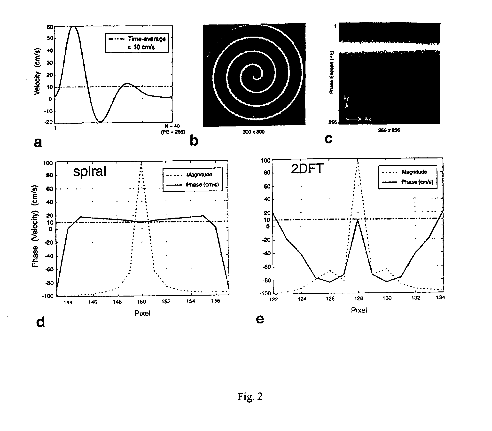 Rapid measurement of time-averaged blood flow using ungated spiral phase-contrast MRI