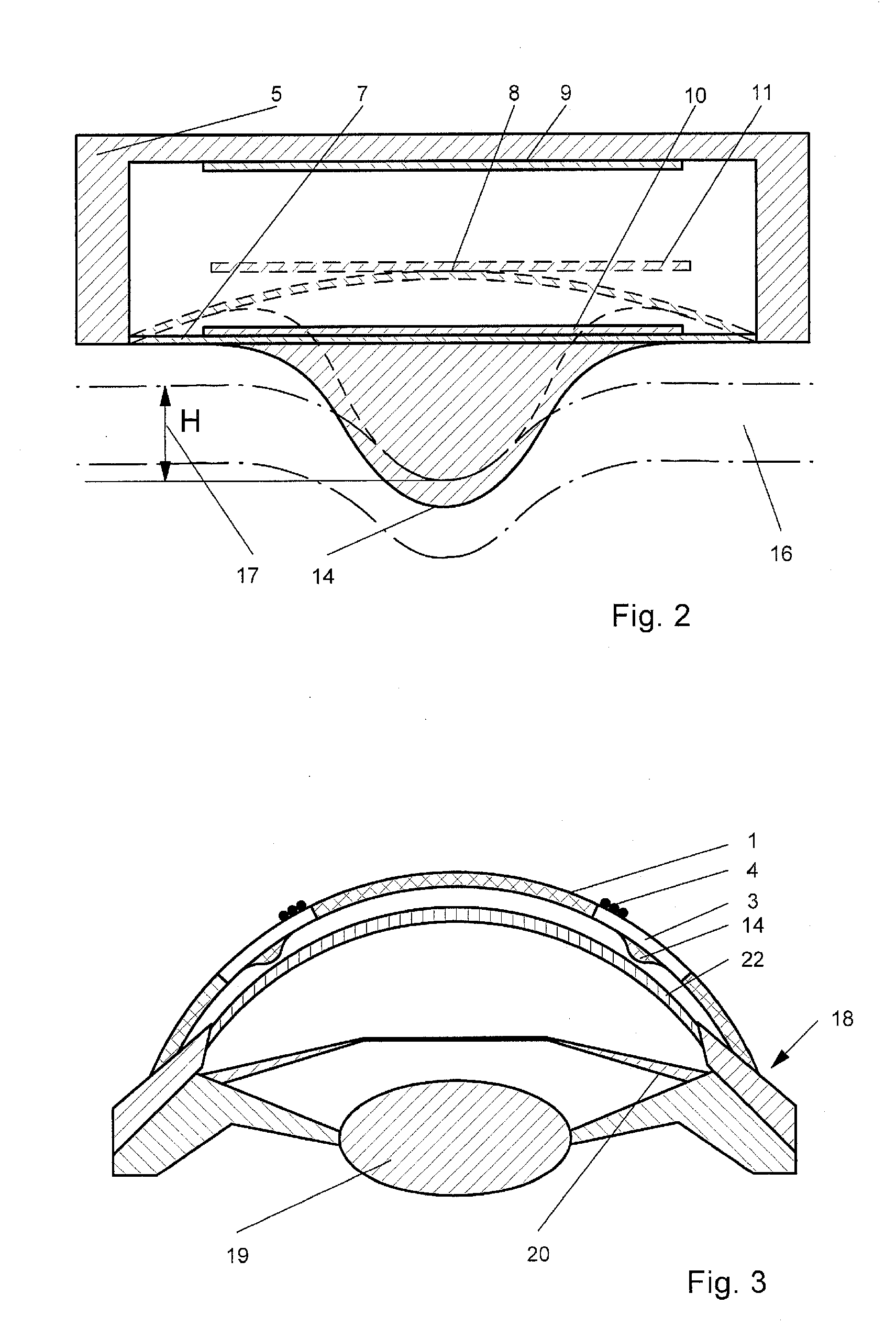 Method and device for monitoring biomechanical properties of the eye