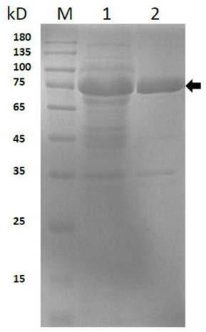 Preparation method and application of cytokine medicine