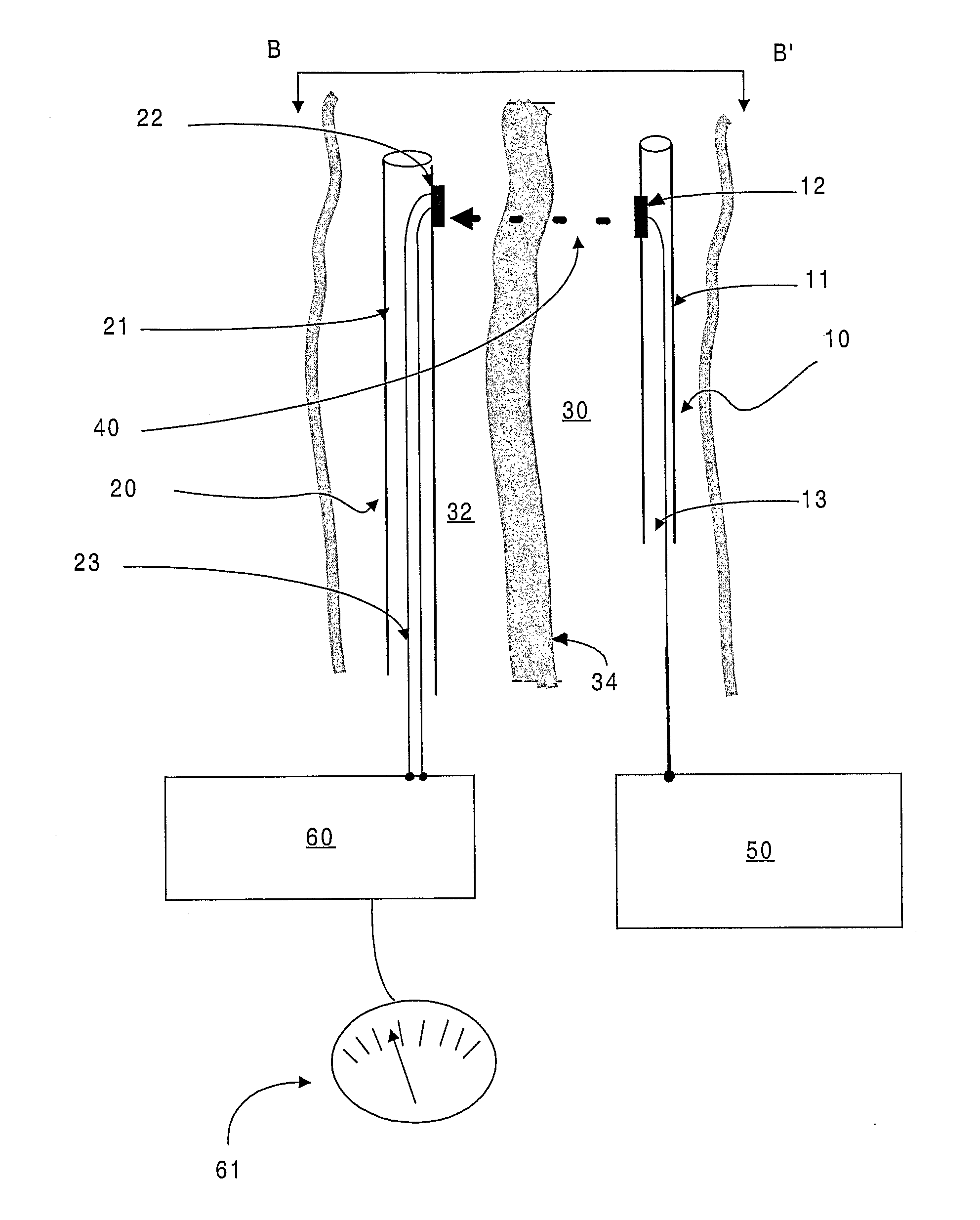 Minimally Invasive Surgical Appartus and Methods
