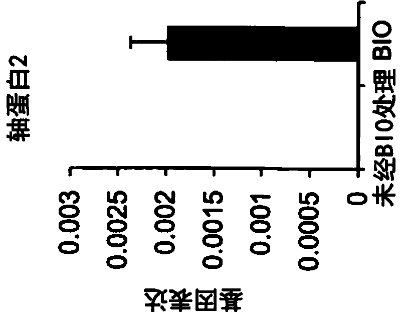 Methods Of Treatment Of Retinal Degeneration Diseases