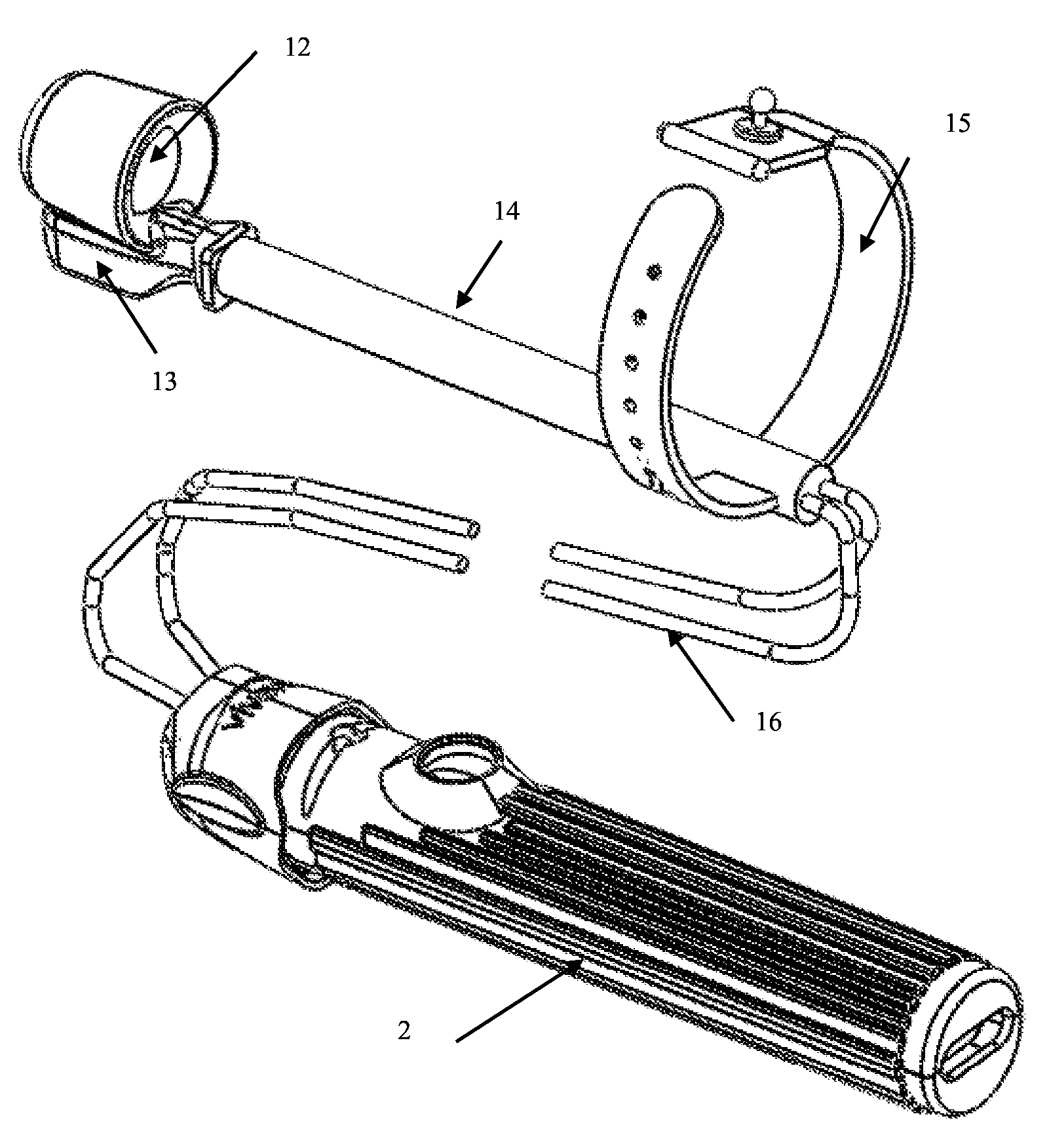 Vaginal remodeling device and method