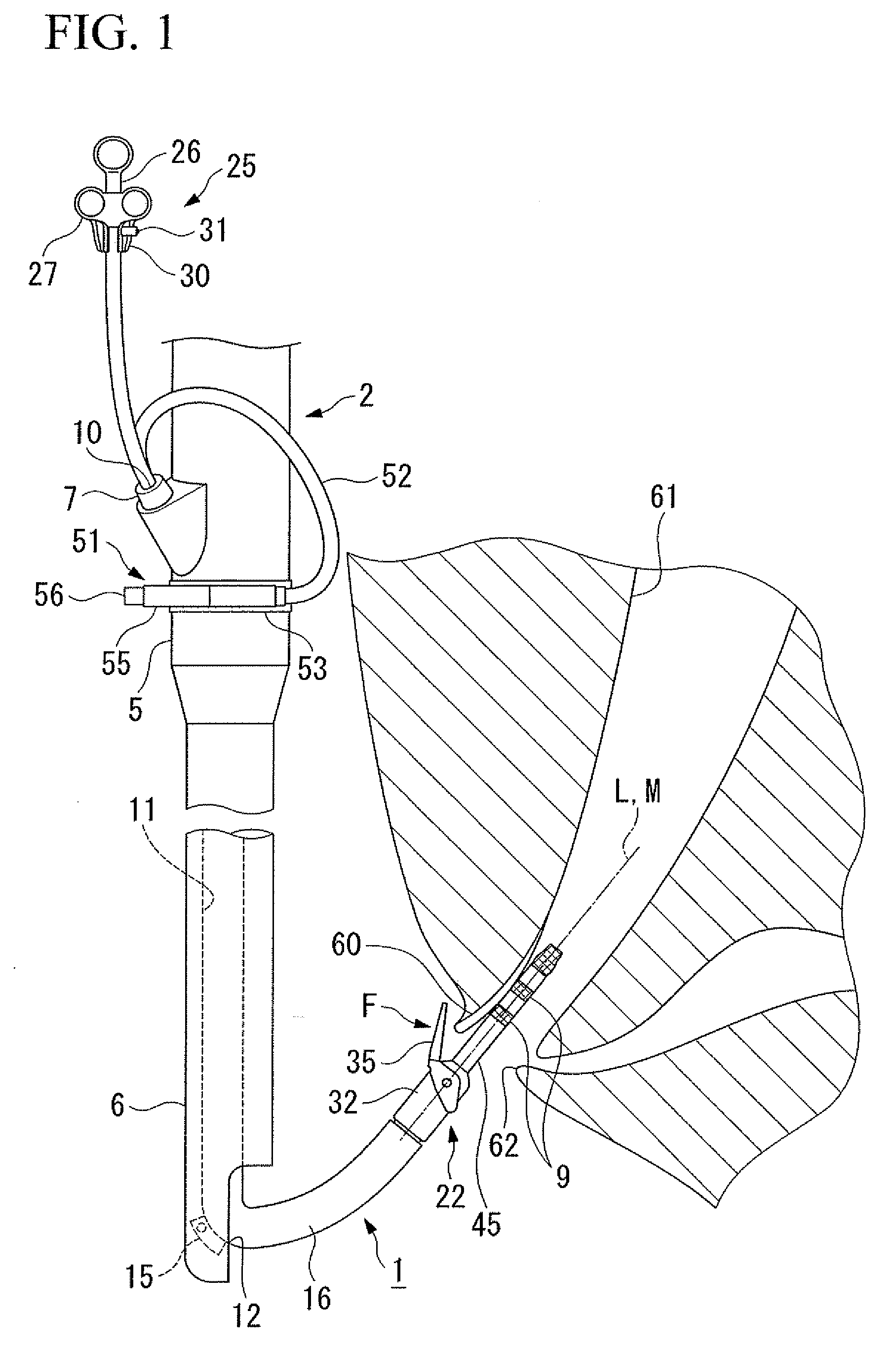 Endoscope device