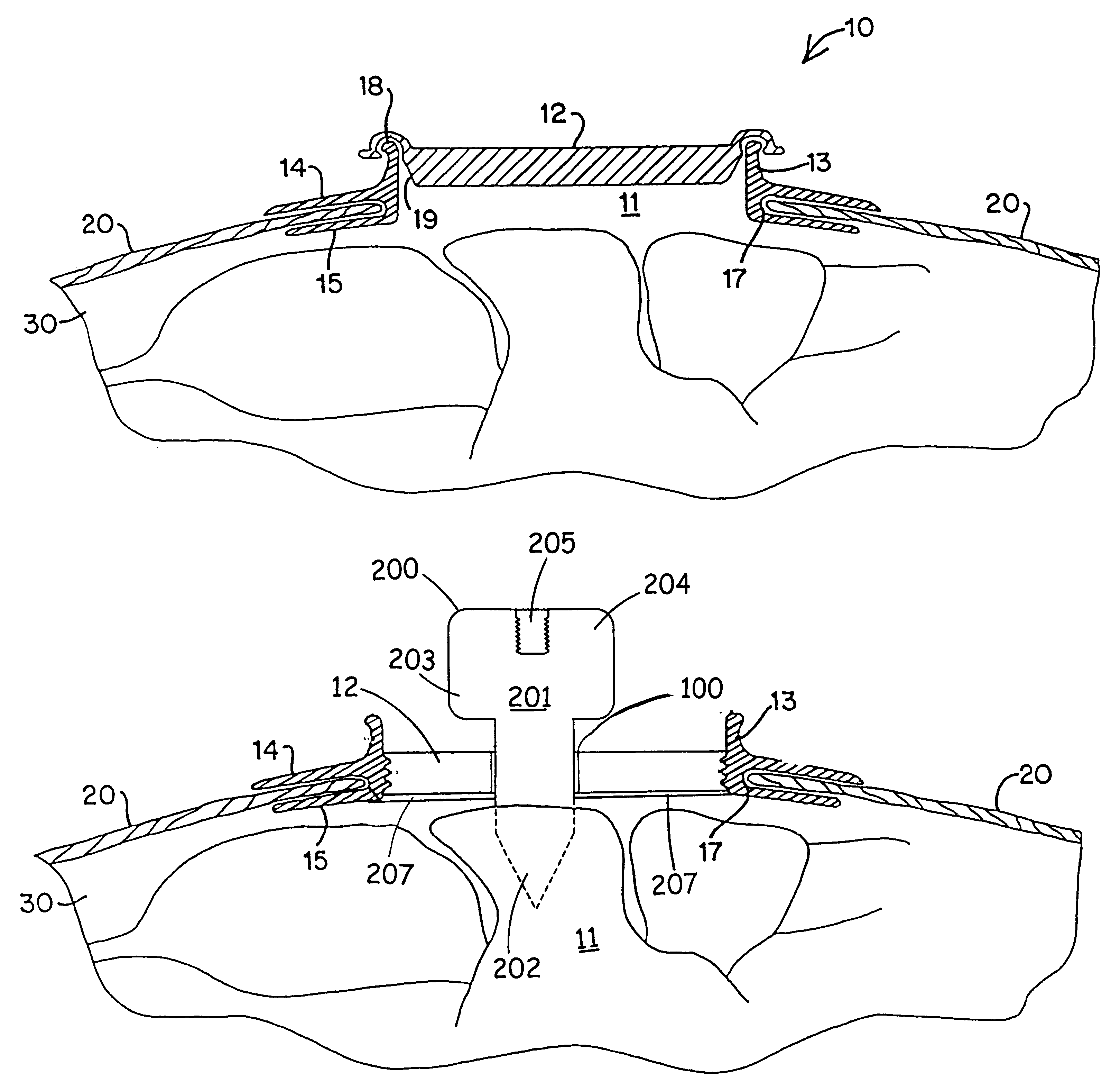 Modified trocar and methods of use
