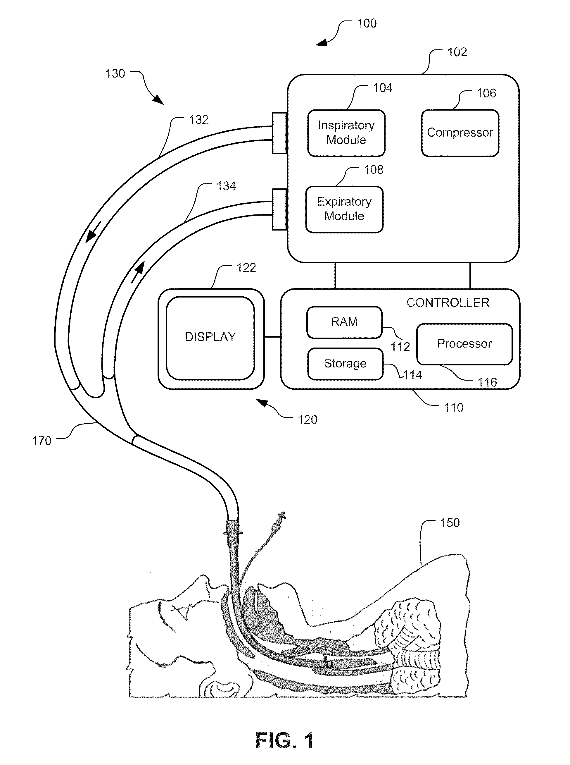 Display And Access To Settings On A Ventilator Graphical User Interface
