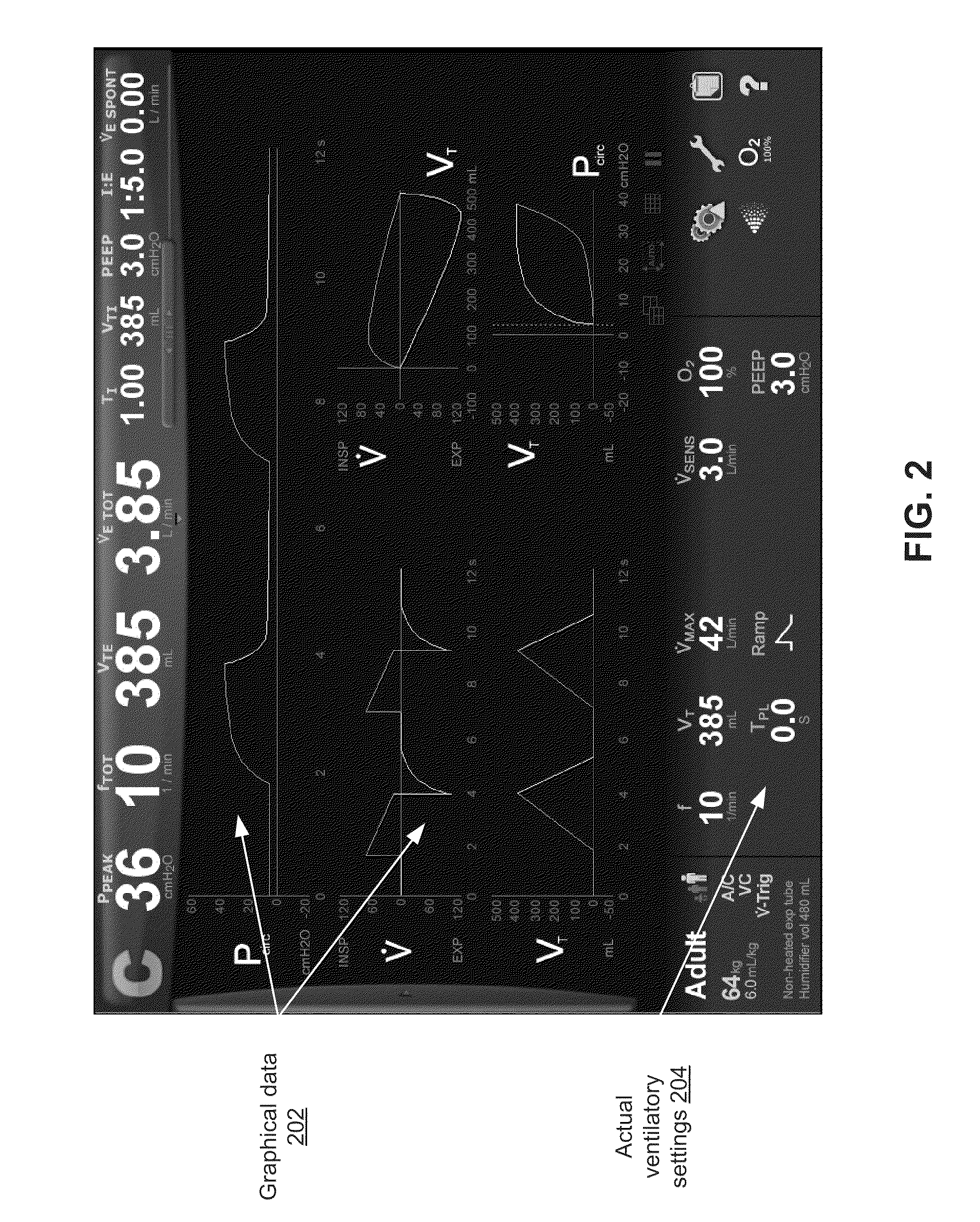 Display And Access To Settings On A Ventilator Graphical User Interface