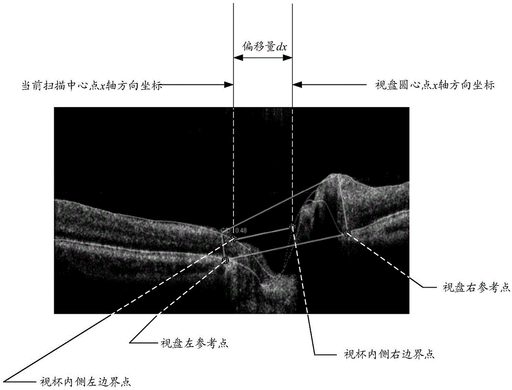 Method and device for obtaining optic disk area through ophthalmic optics coherence tomography images