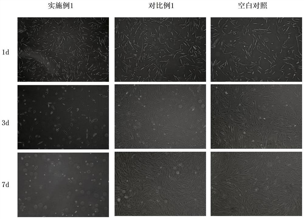 Photocuring anti-adhesion gel and preparation method thereof