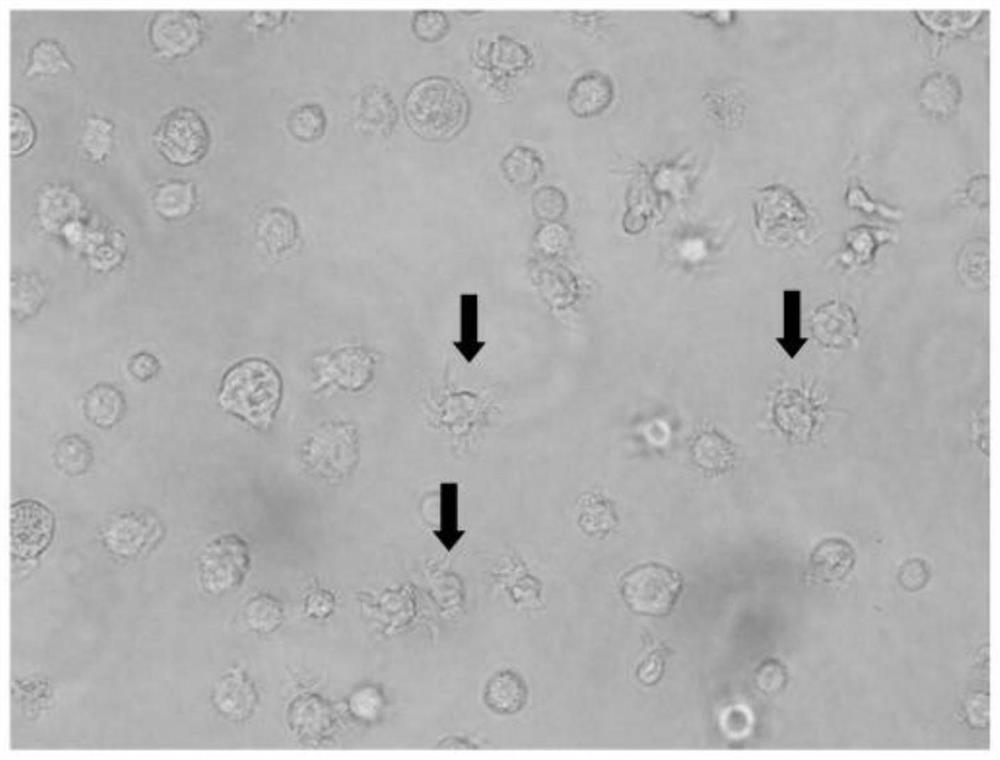 A special medium and culture method for inducing mouse bone marrow cells to stably differentiate into immature dendritic cells