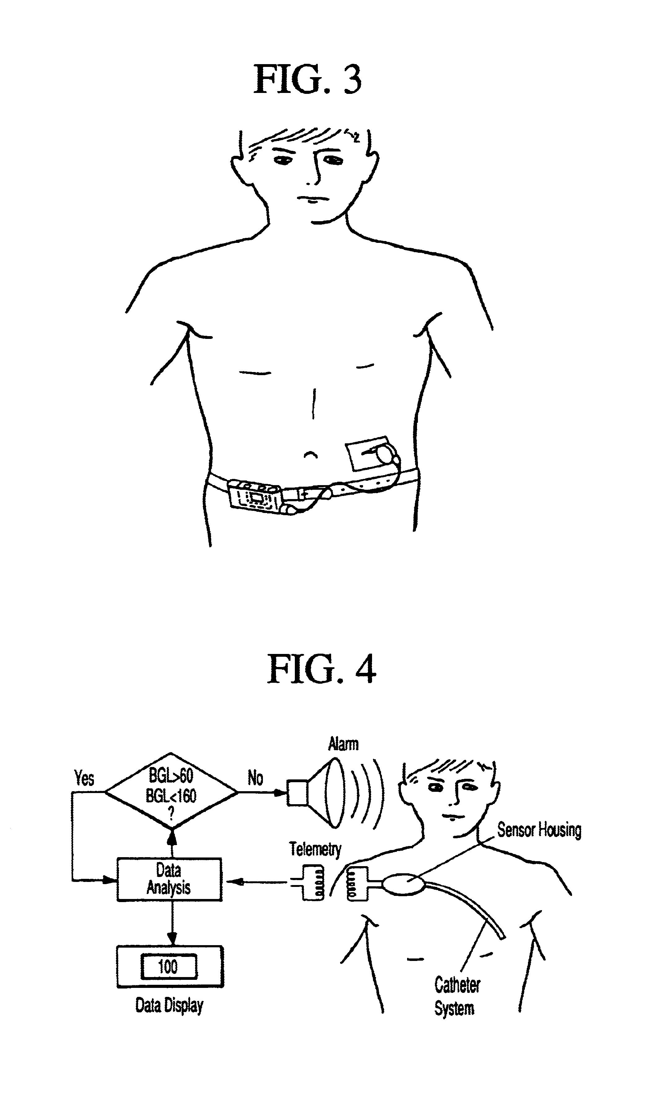 Device for measuring human blood sugar levels