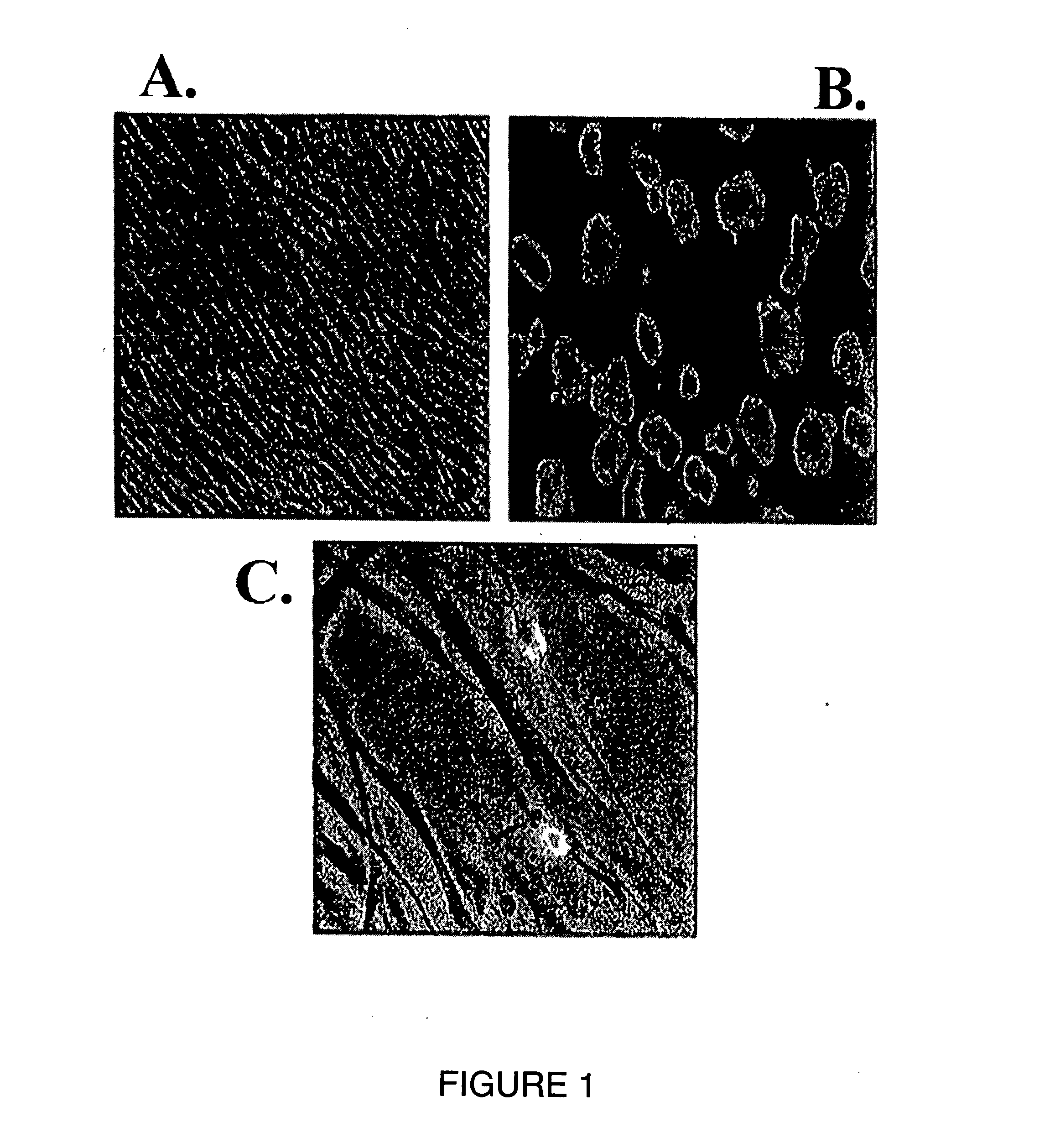 Dopaminergic neurons derived from corneal limbus, methods of isolation and uses thereof