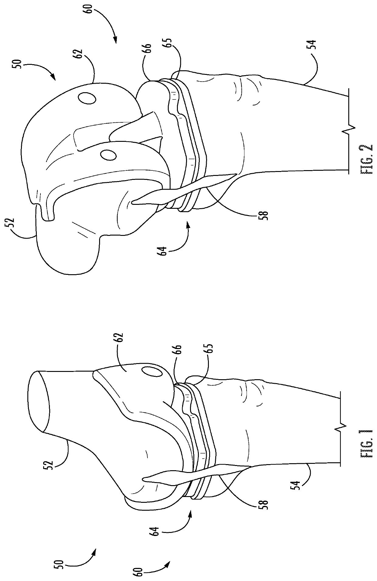Methods and instrumentation for balancing of ligaments in flexion