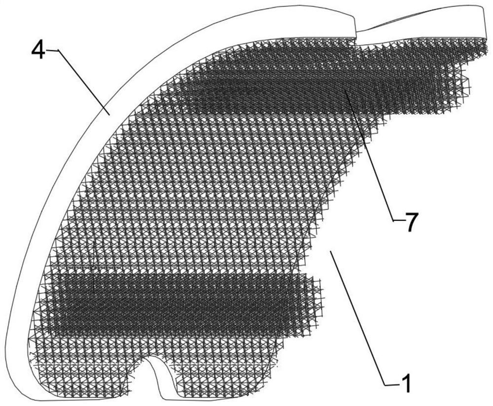 Zirconium-niobium alloy ankle joint prosthesis system containing oxide layer and preparation method thereof