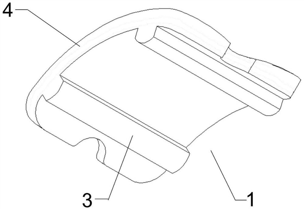 Zirconium-niobium alloy ankle joint prosthesis system containing oxide layer and preparation method thereof