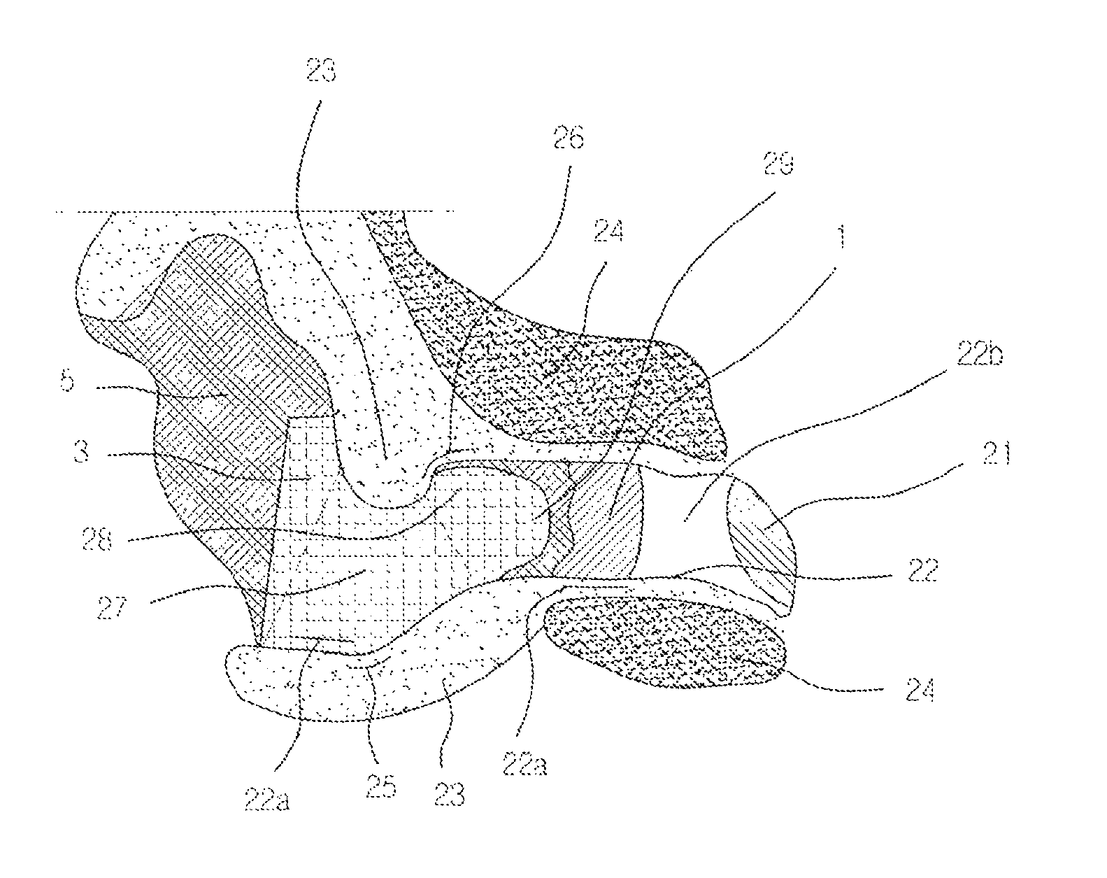 Method of manufacturing standard ear shells for in-the-ear type general-purpose hearing aids