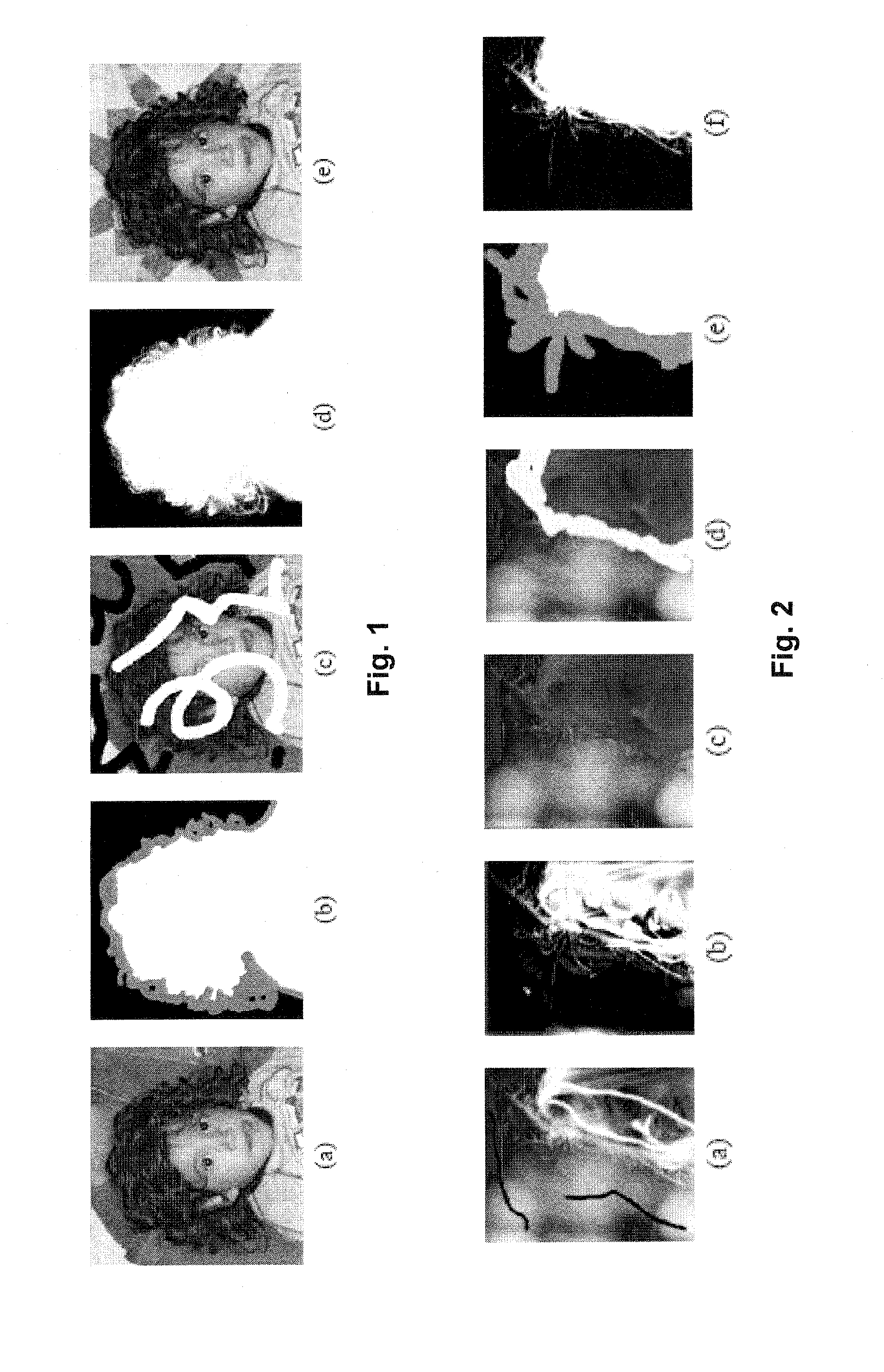 Closed form method and system for matting a foreground object in an image having a background