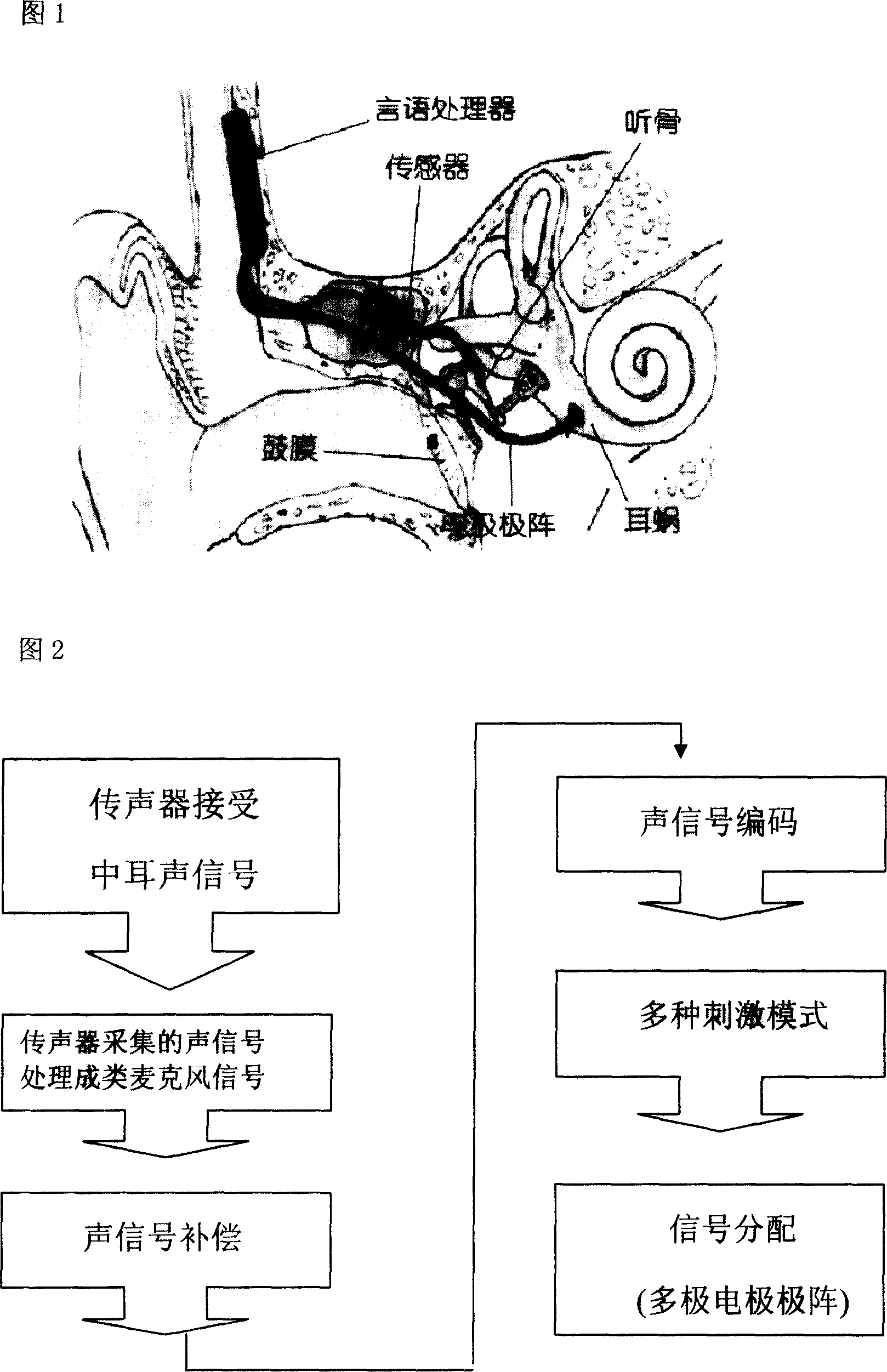 Full-implanting type artificial cochlea and method for making same