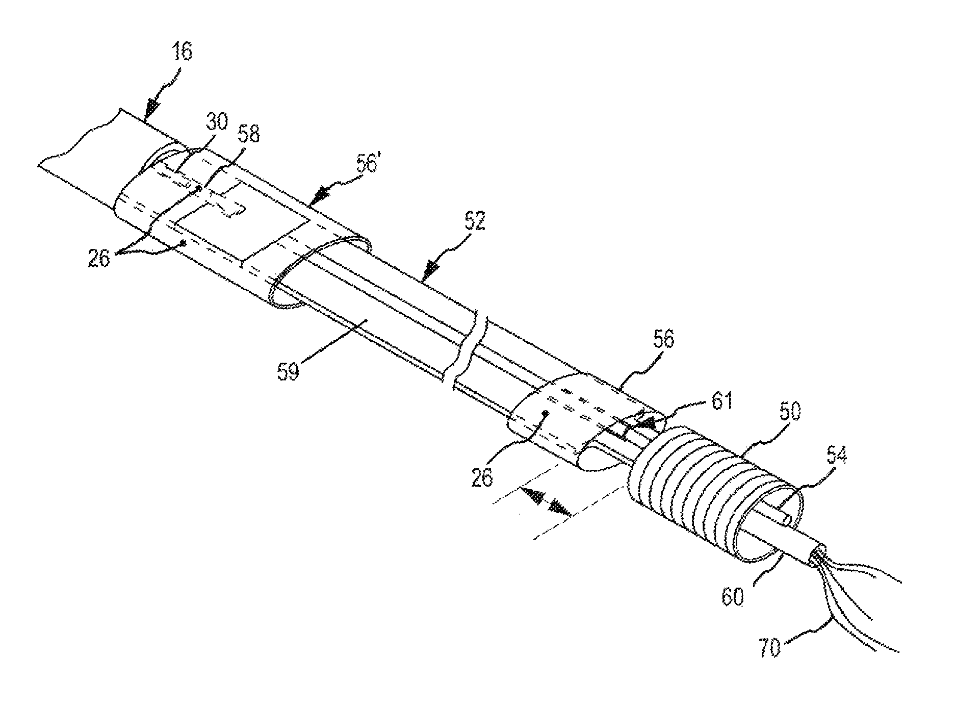 In-plane dual loop fixed diameter electrophysiology catheters and methods of manufacturing therefor