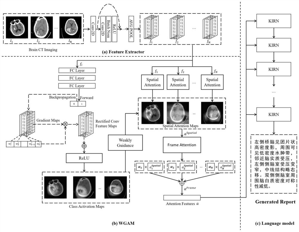 Brain CT medical report automatic generation method based on weak supervision attention