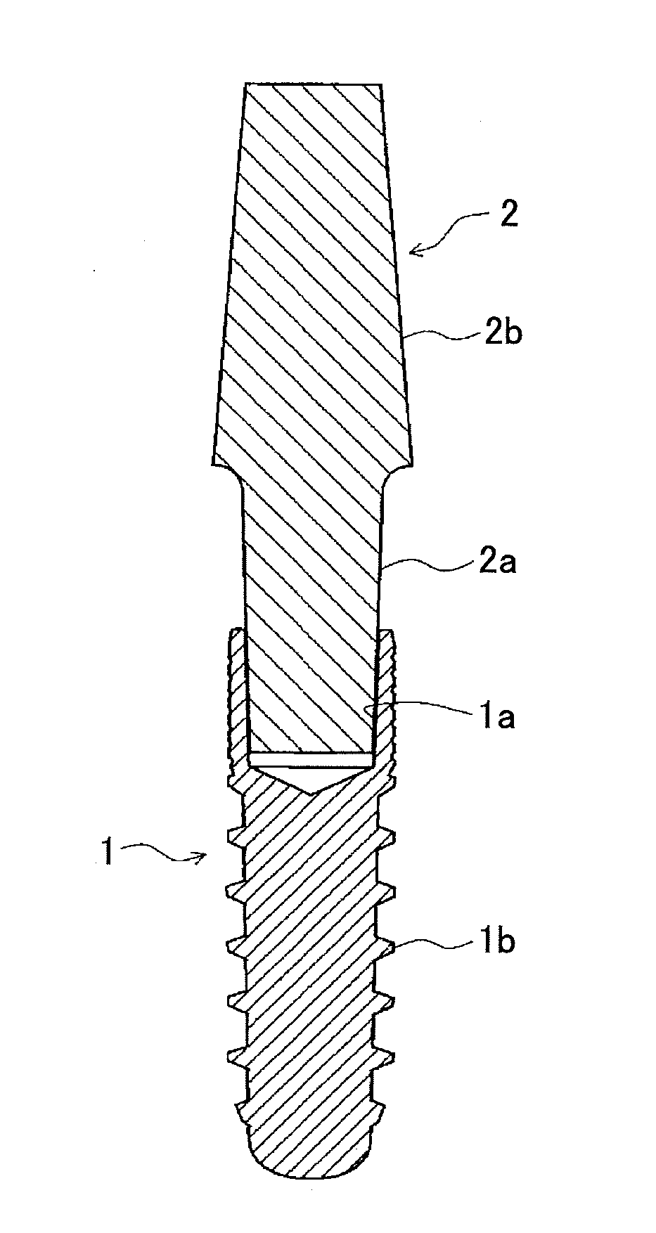 Method for manufacturing one-piece dental implant