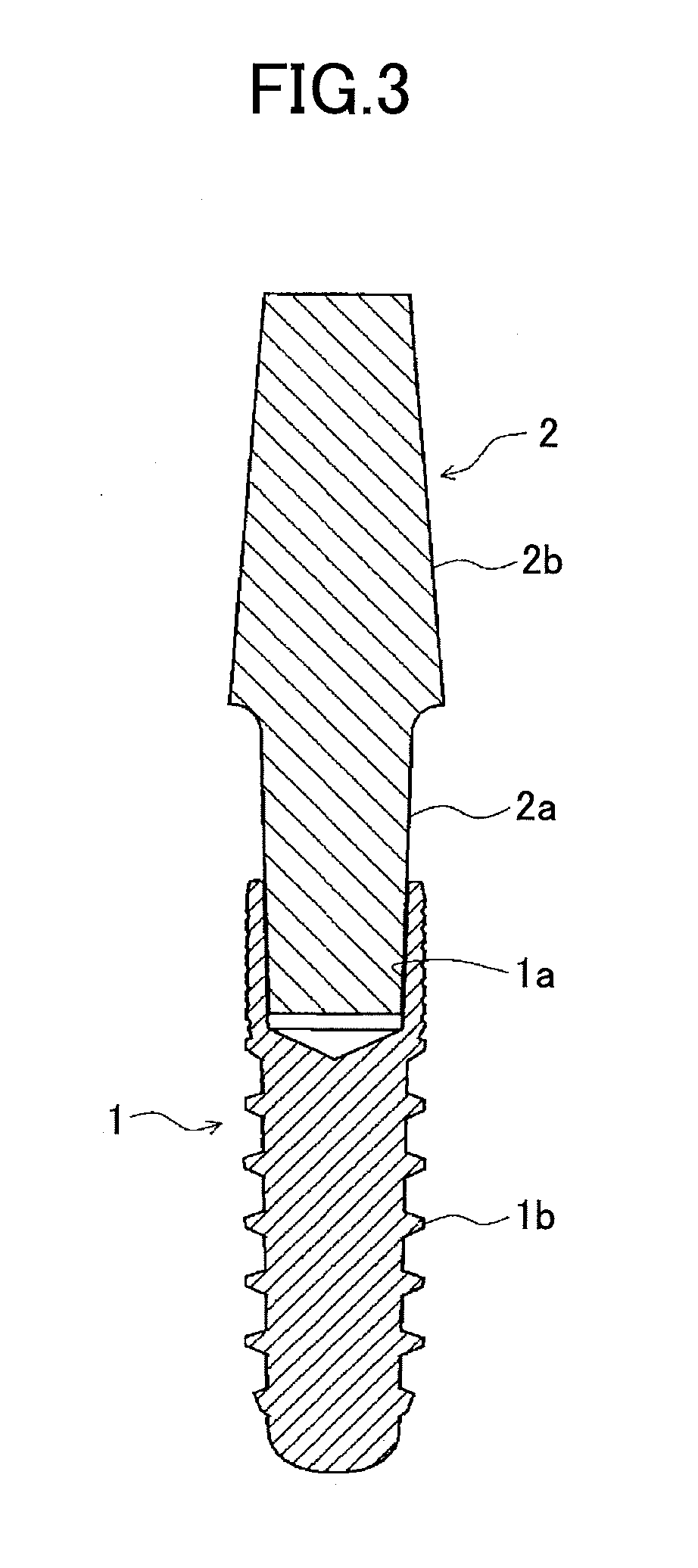 Method for manufacturing one-piece dental implant
