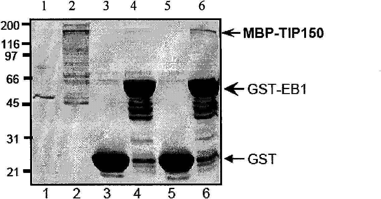 Microtubule-associated protein and coding genes and application thereof