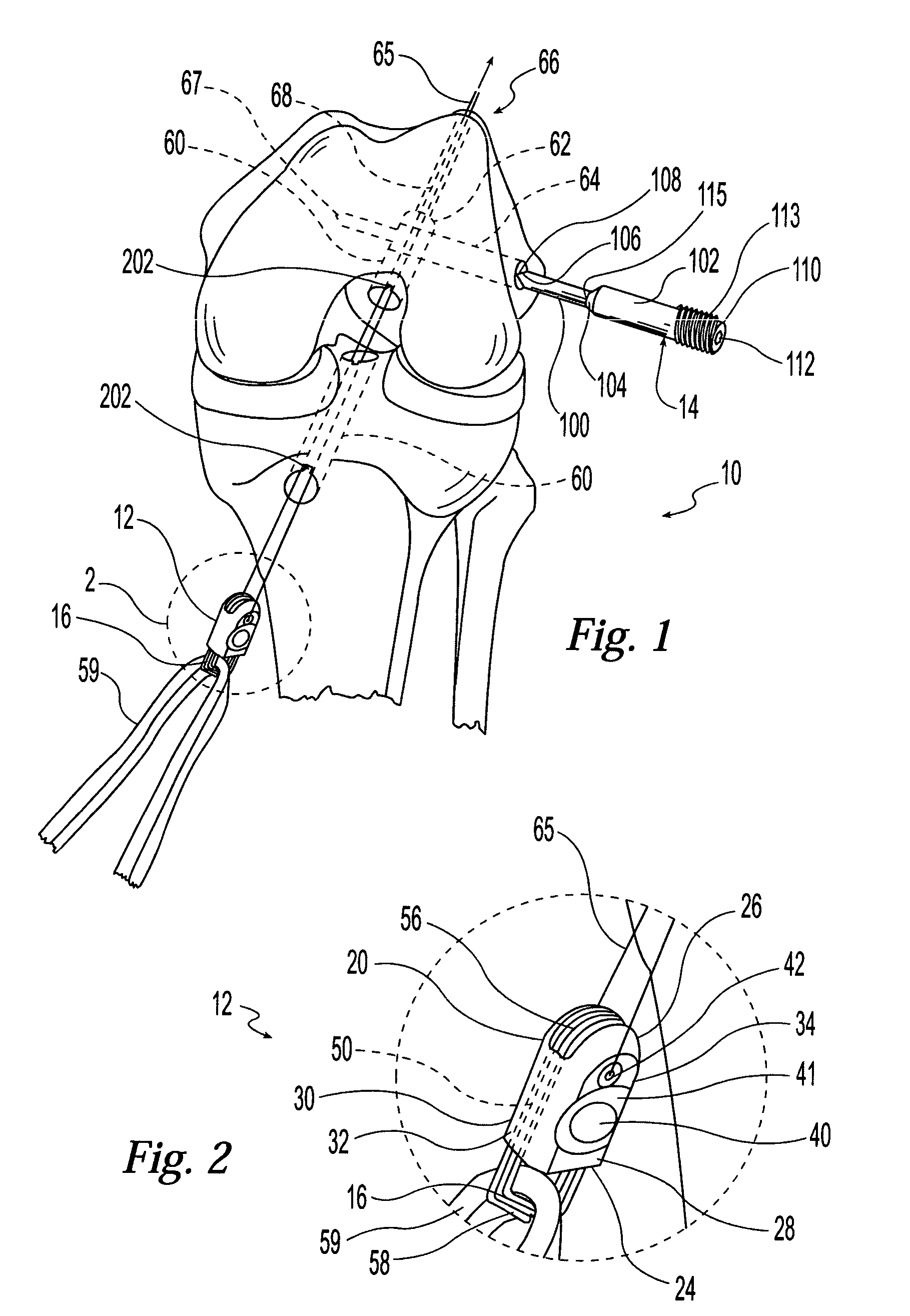 Cross-pin graft fixation instruments and method
