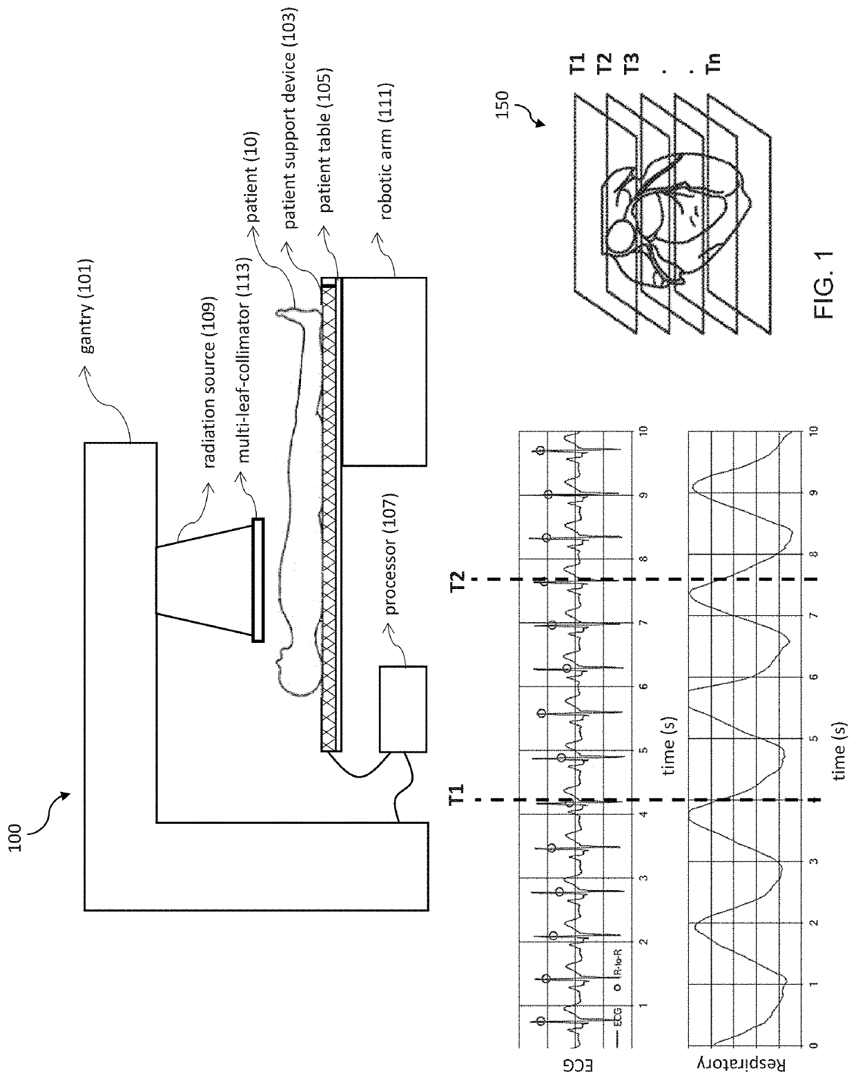 Systems and methods of body motion management during non-invasive imaging and treatment procedures