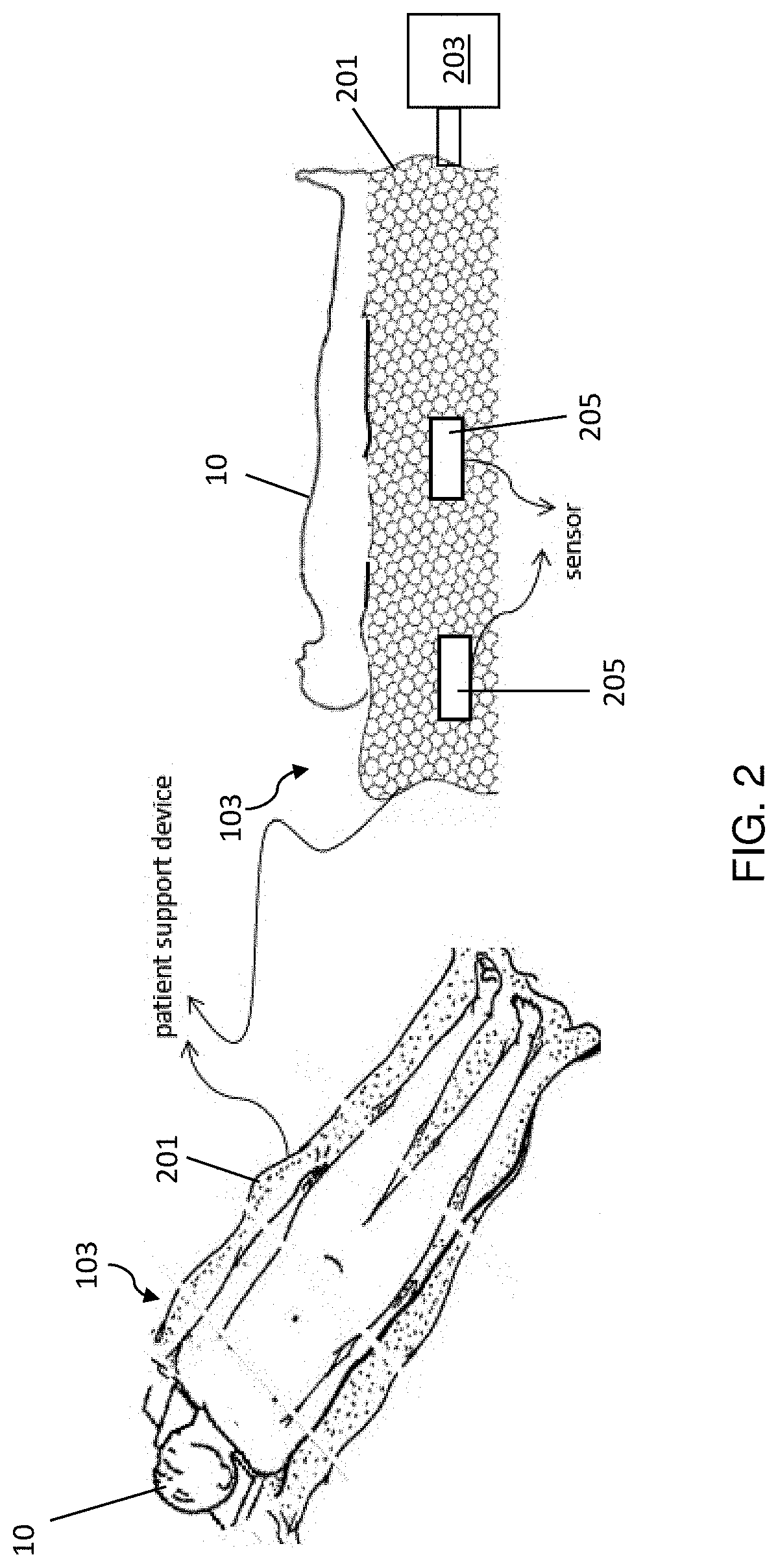Systems and methods of body motion management during non-invasive imaging and treatment procedures