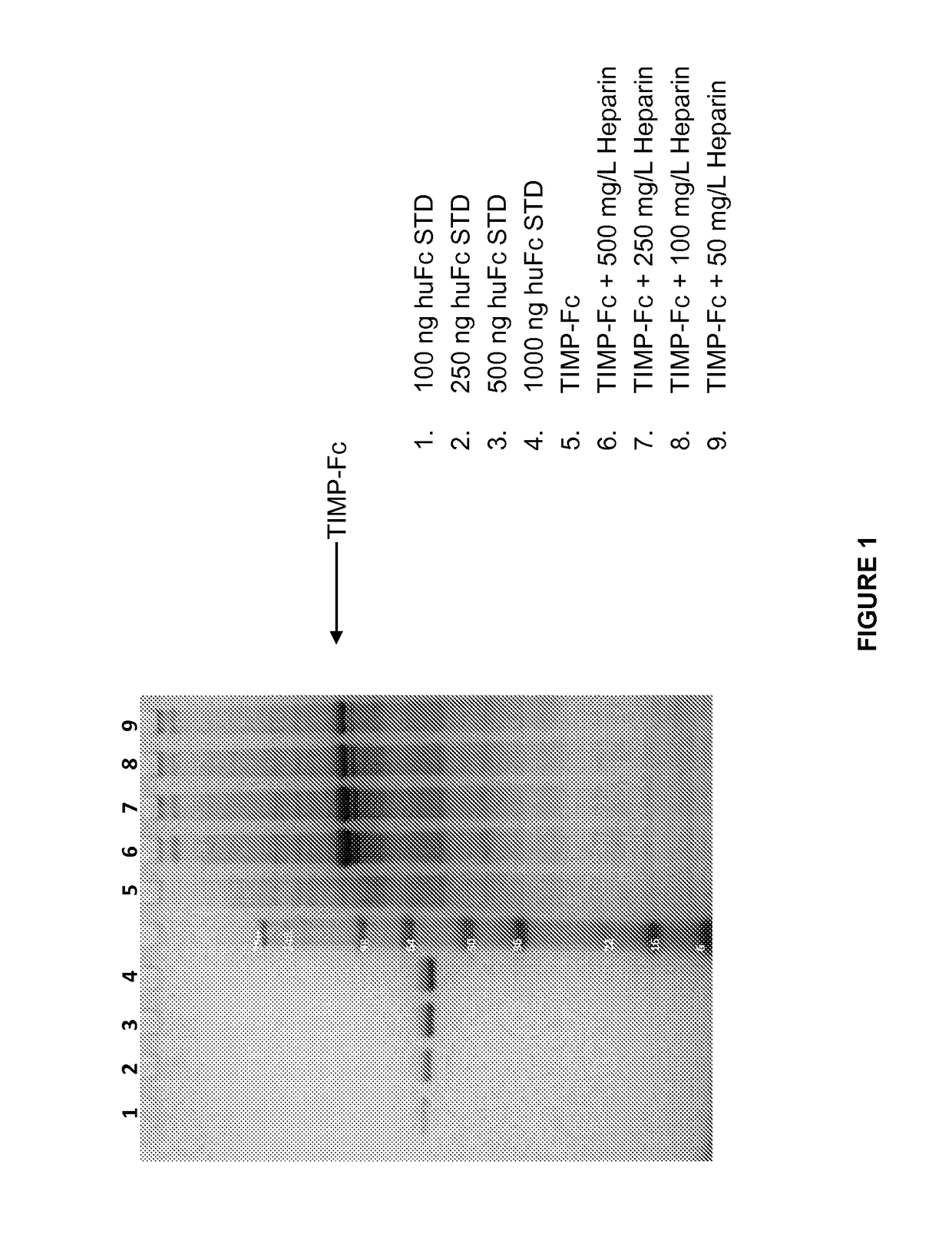 Variants of tissue inhibitor or metalloprotienase type three (timp-3), compositions and methods