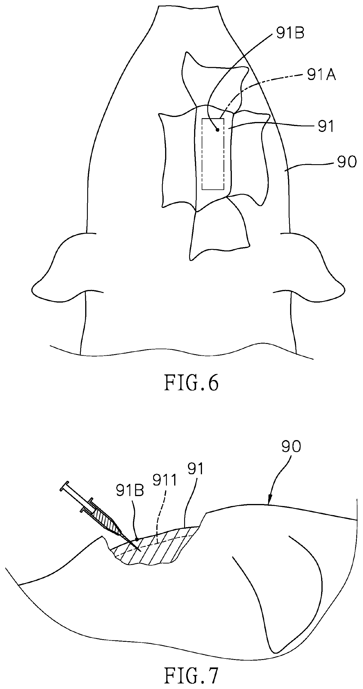 Animal model for generating a stereotype of focal onset seizures