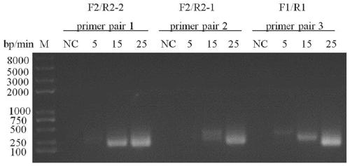 Real-time recombinase-mediated isothermal amplification nucleic acid kit for rapid detection of toxoplasma gondii and application thereof